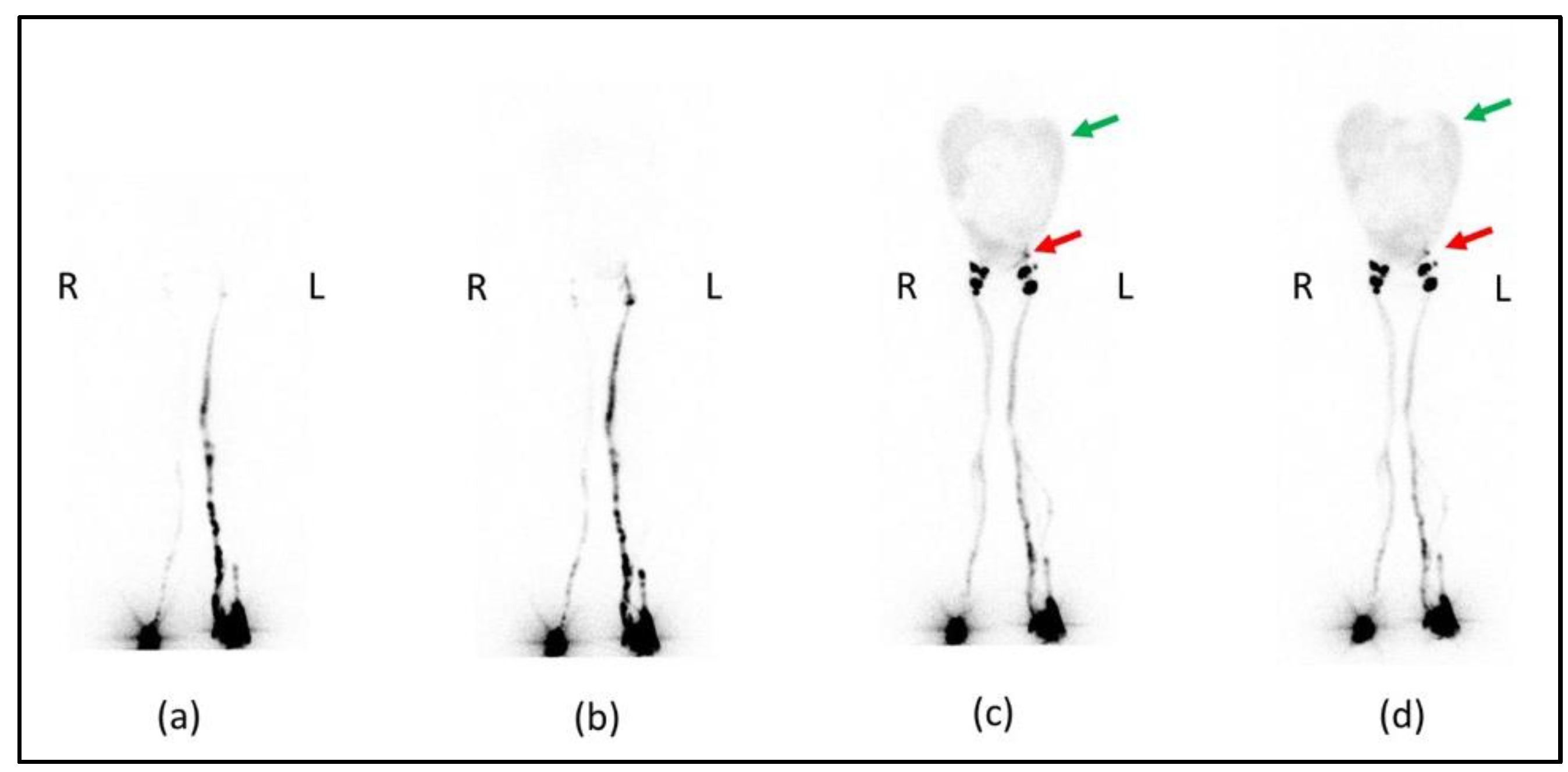 Biomedicines 11 00282 g003 Biomedicines 11 00282 g003