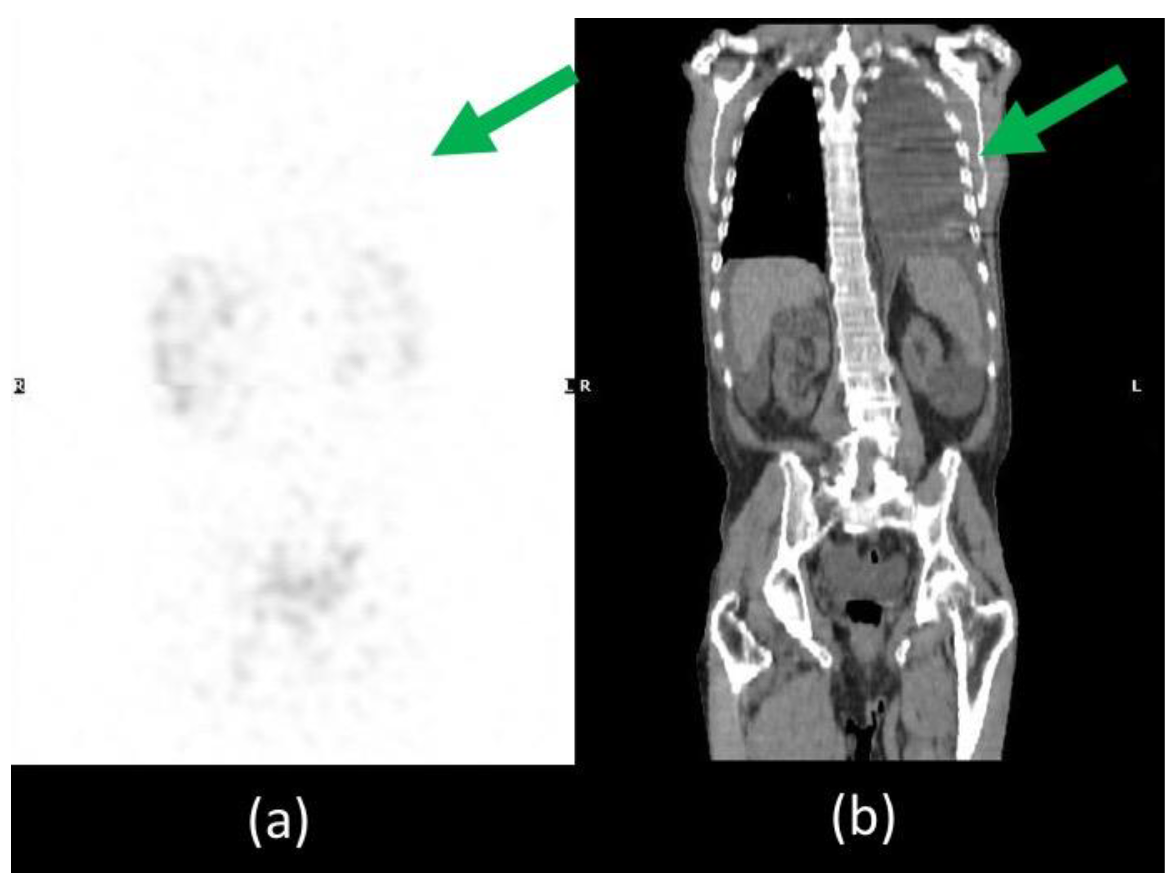 Biomedicines 11 00282 g005 Biomedicines 11 00282 g005