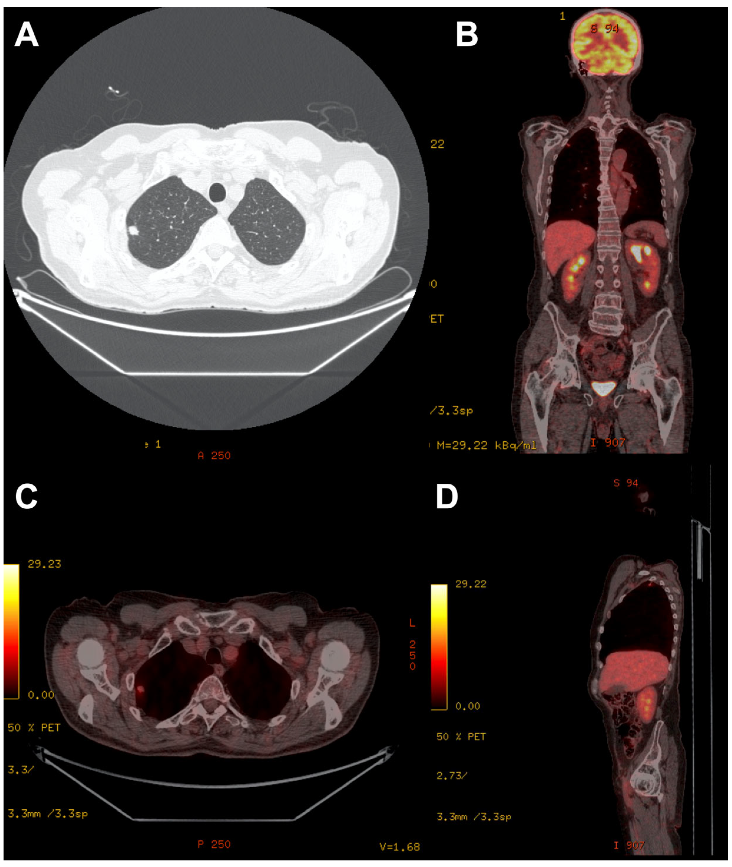 Biomedicines 11 00283 g001