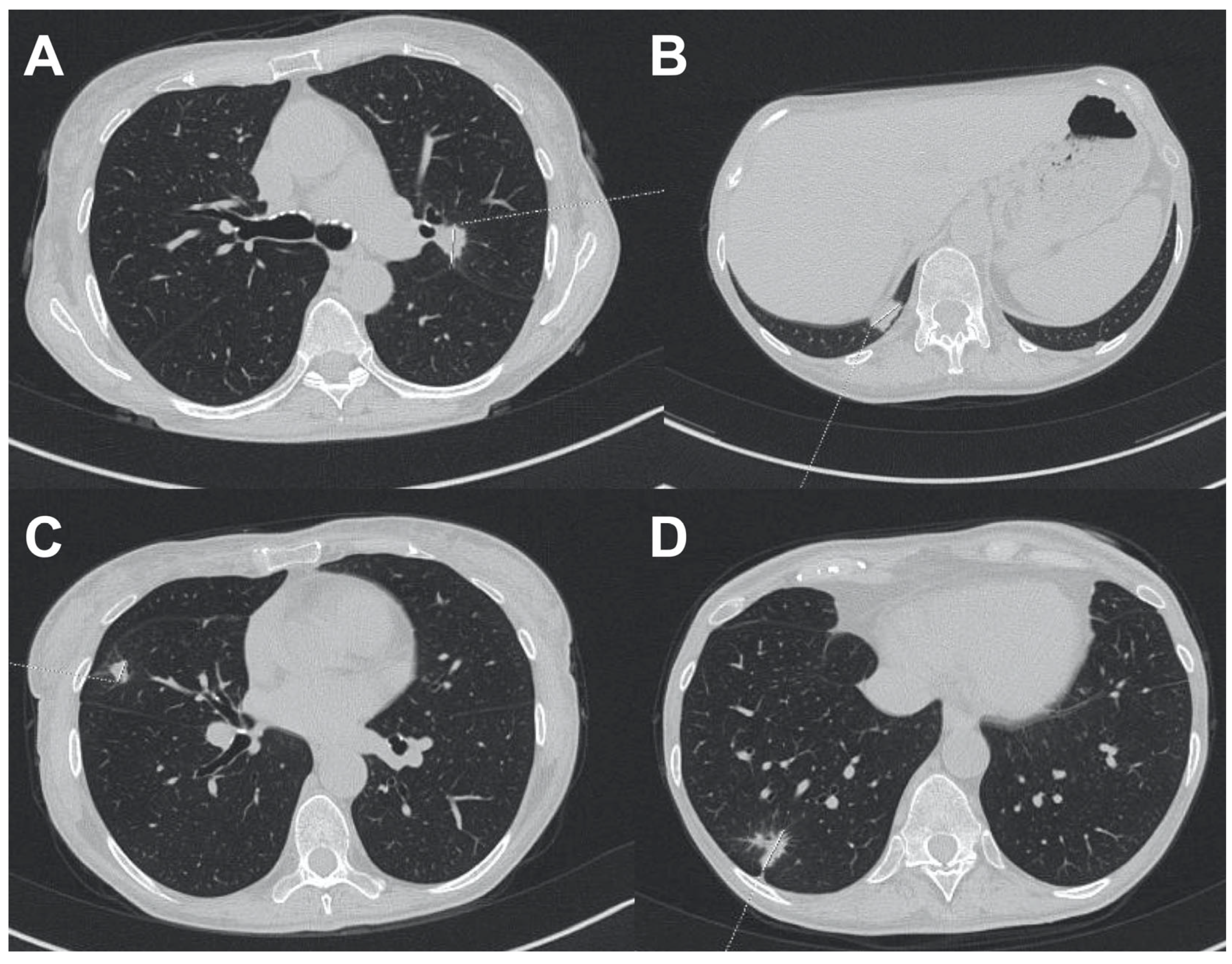 Biomedicines 11 00283 g005