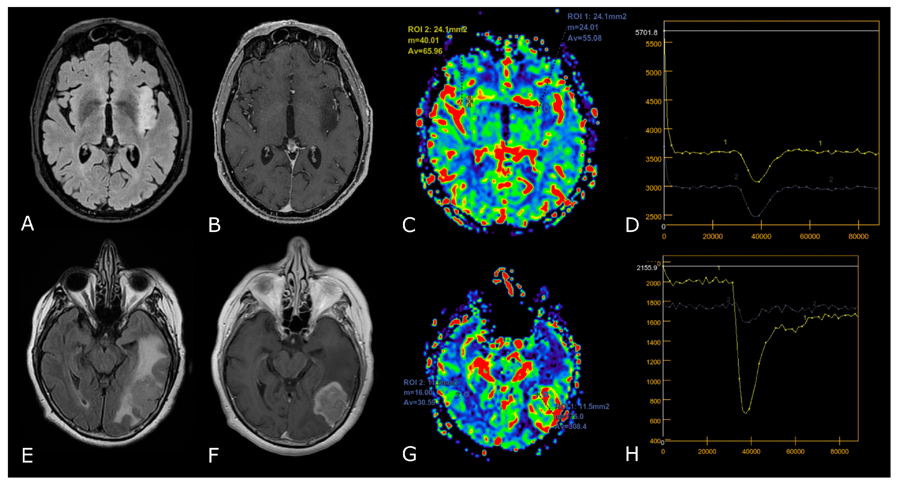 Biomedicines 11 00364 g004 Biomedicines 11 00364 g004