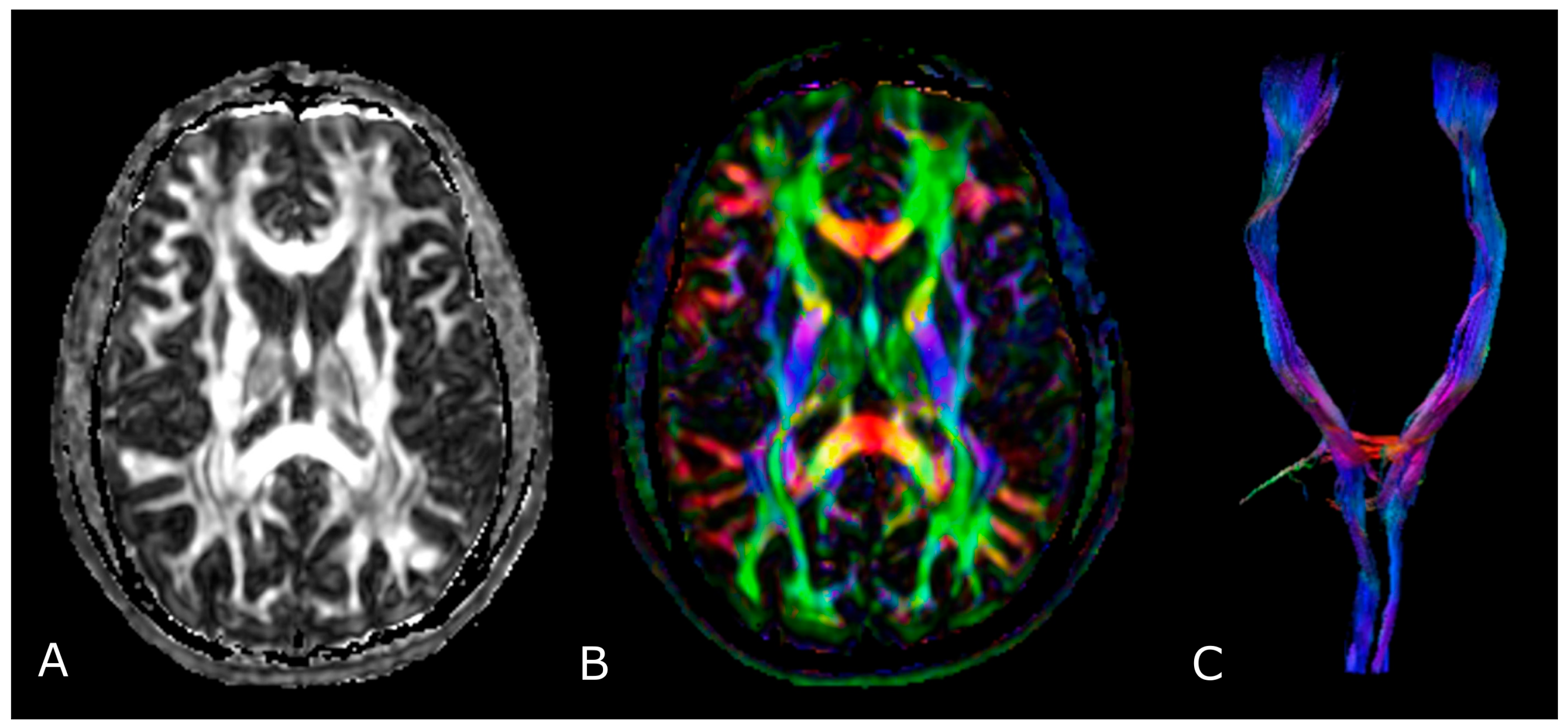 Biomedicines 11 00364 g006 Biomedicines 11 00364 g006