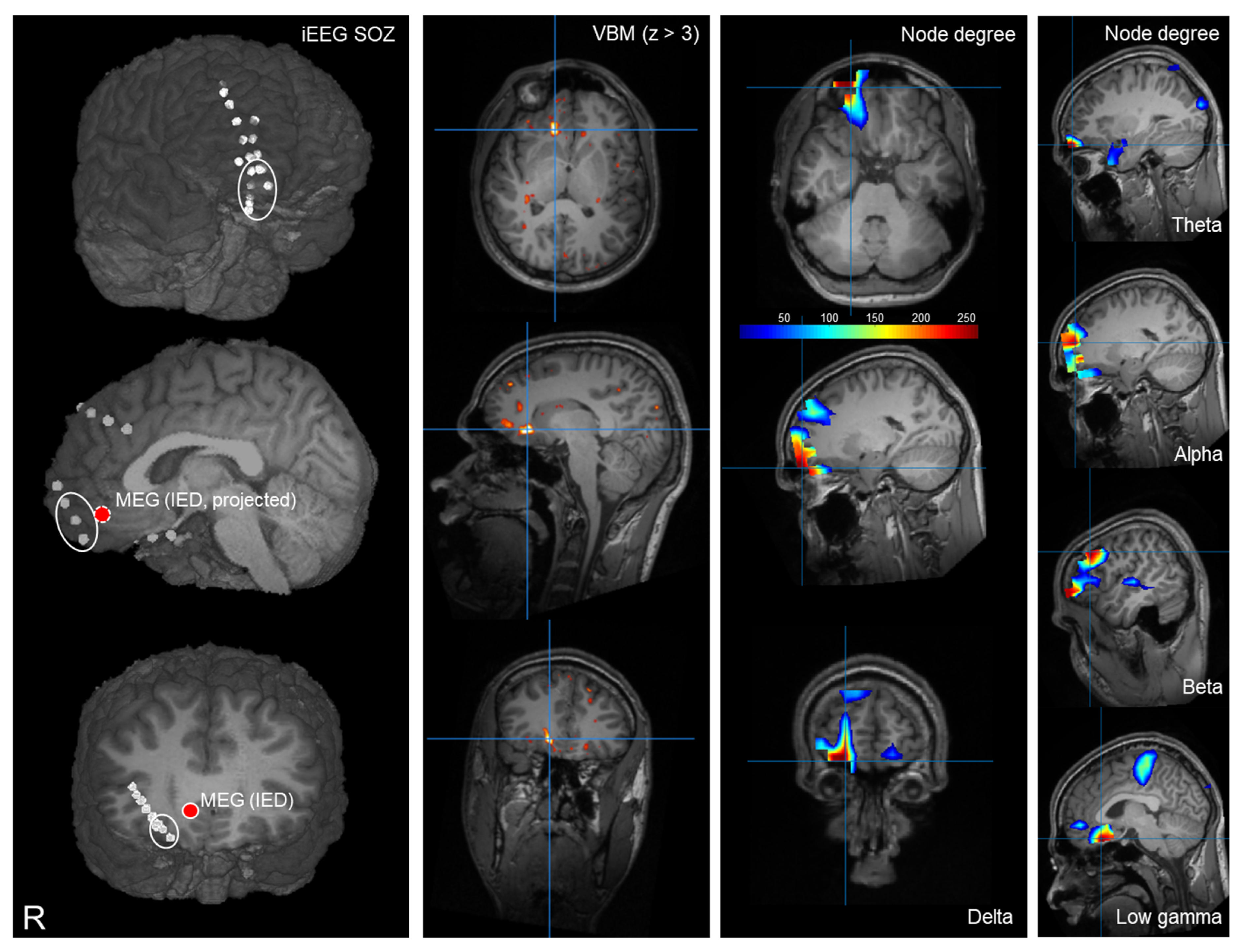 Biomedicines 11 00438 g001 Biomedicines 11 00438 g001