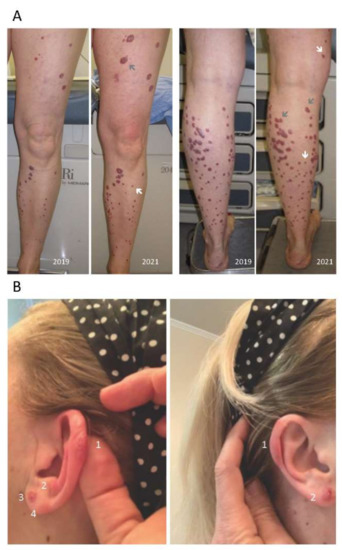 Biomedicines 11 00634 g001