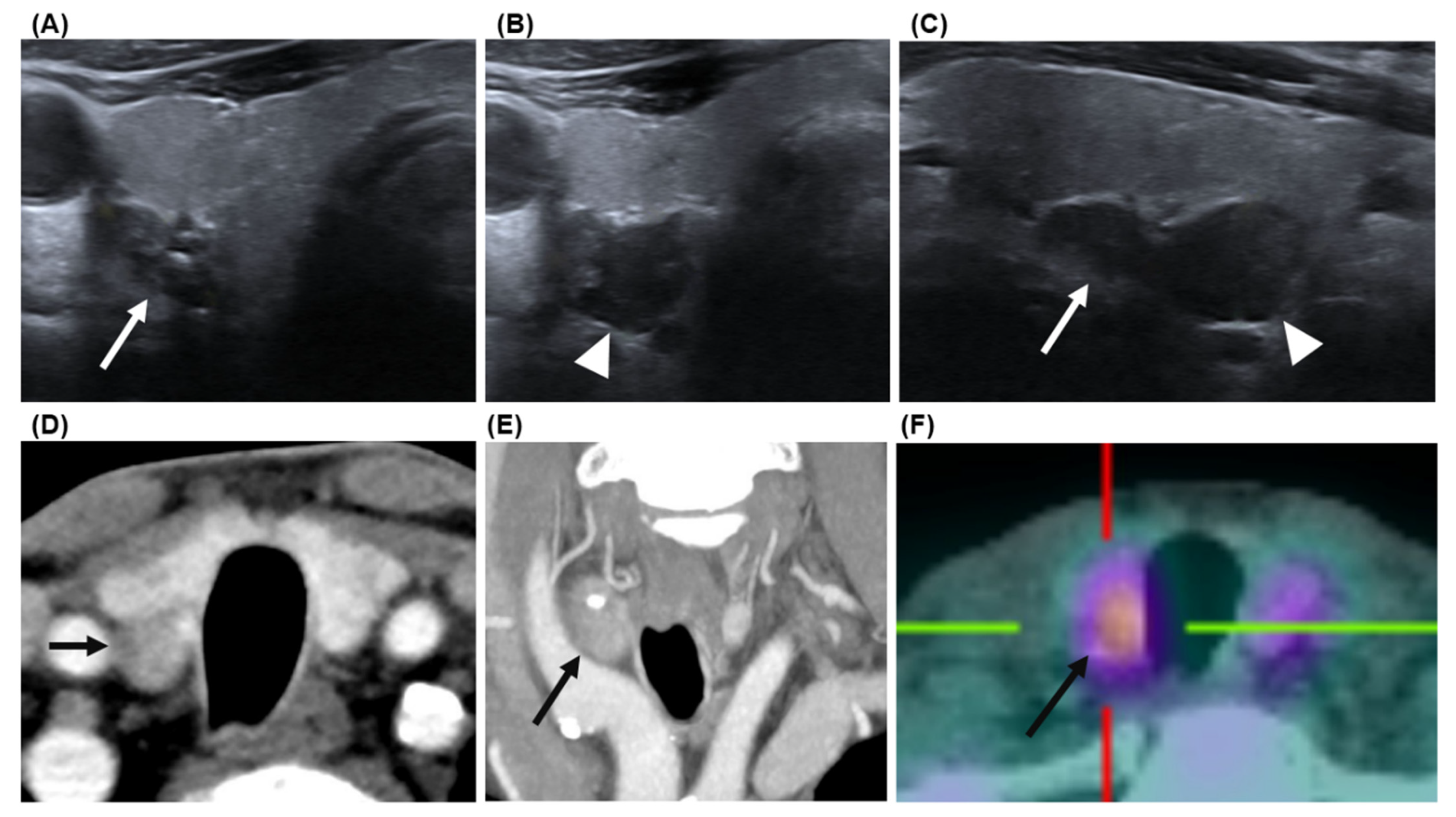 Biomedicines 11 00672 g003