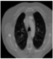 Biomedicines 11 00679 i002