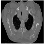 Biomedicines 11 00679 i004