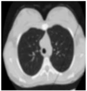 Biomedicines 11 00679 i008