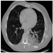 Biomedicines 11 00679 i010