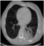 Biomedicines 11 00679 i011