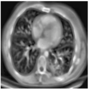 Biomedicines 11 00679 i012