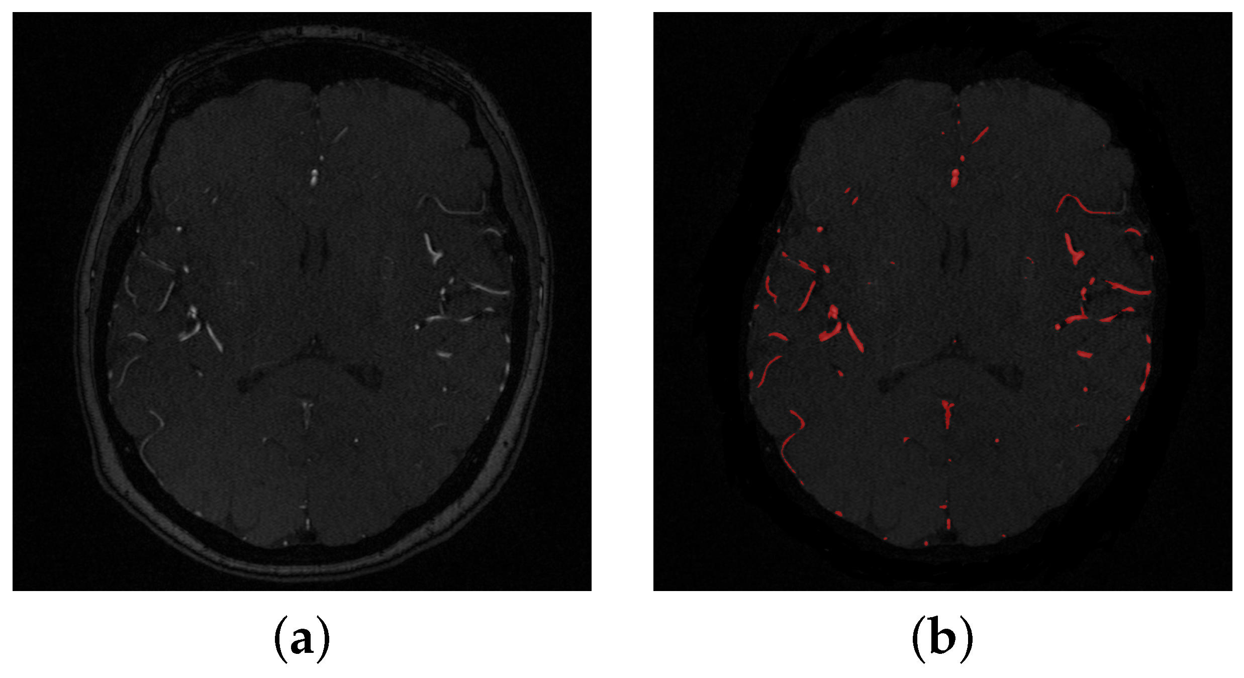 Biomedicines 11 00849 g003