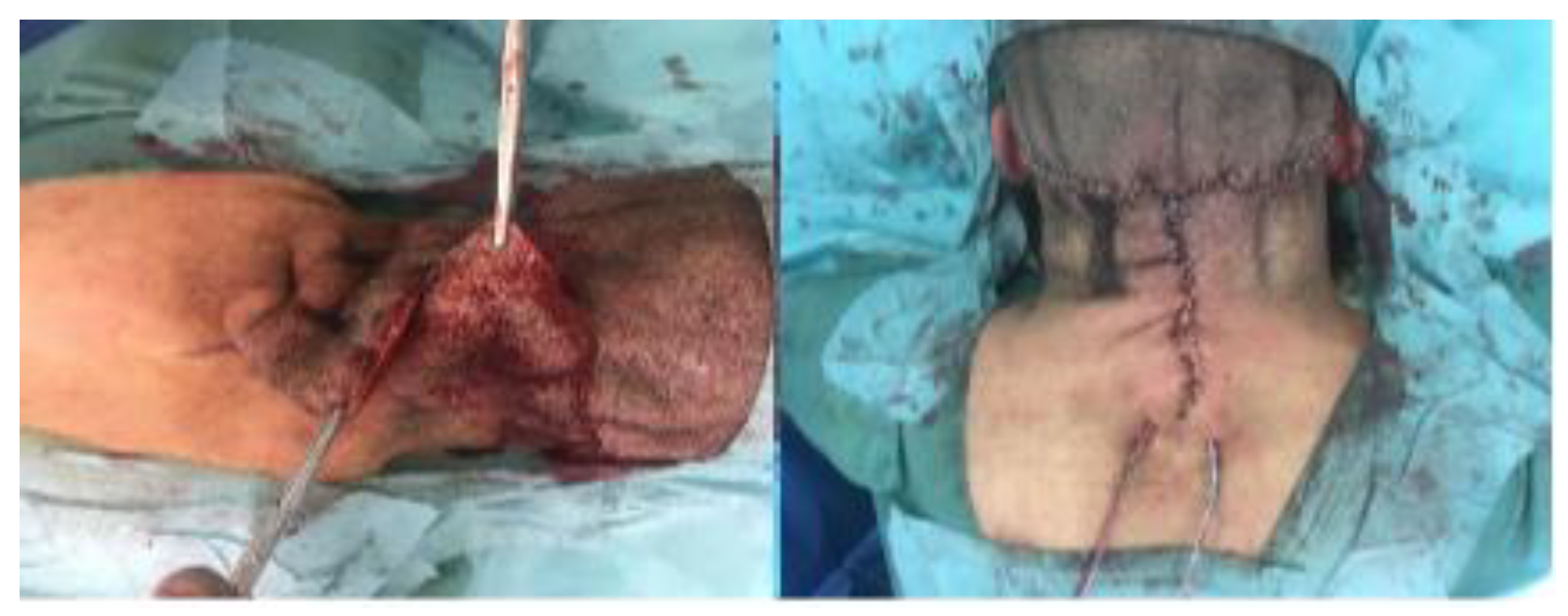 Biomedicines 11 00984 g004 Biomedicines 11 00984 g004