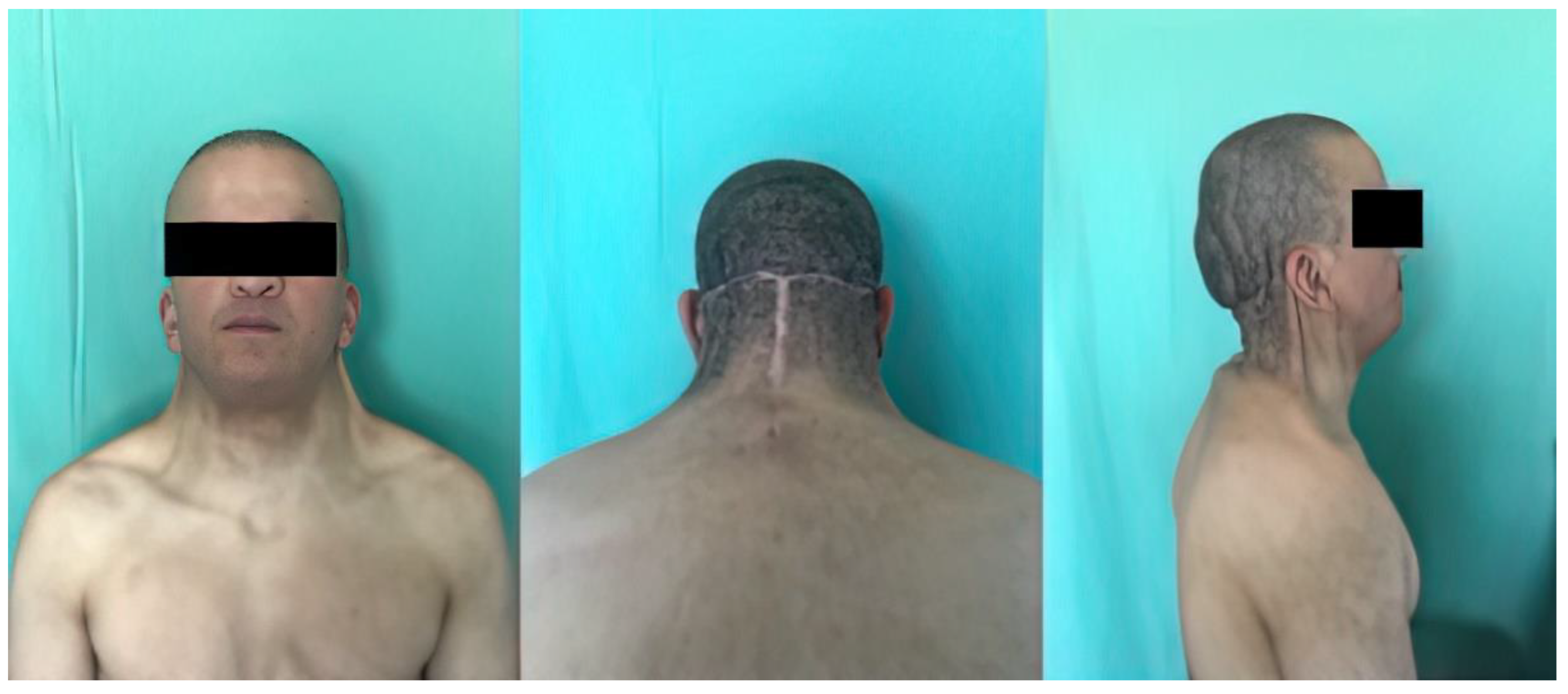 Biomedicines 11 00984 g005 Biomedicines 11 00984 g005