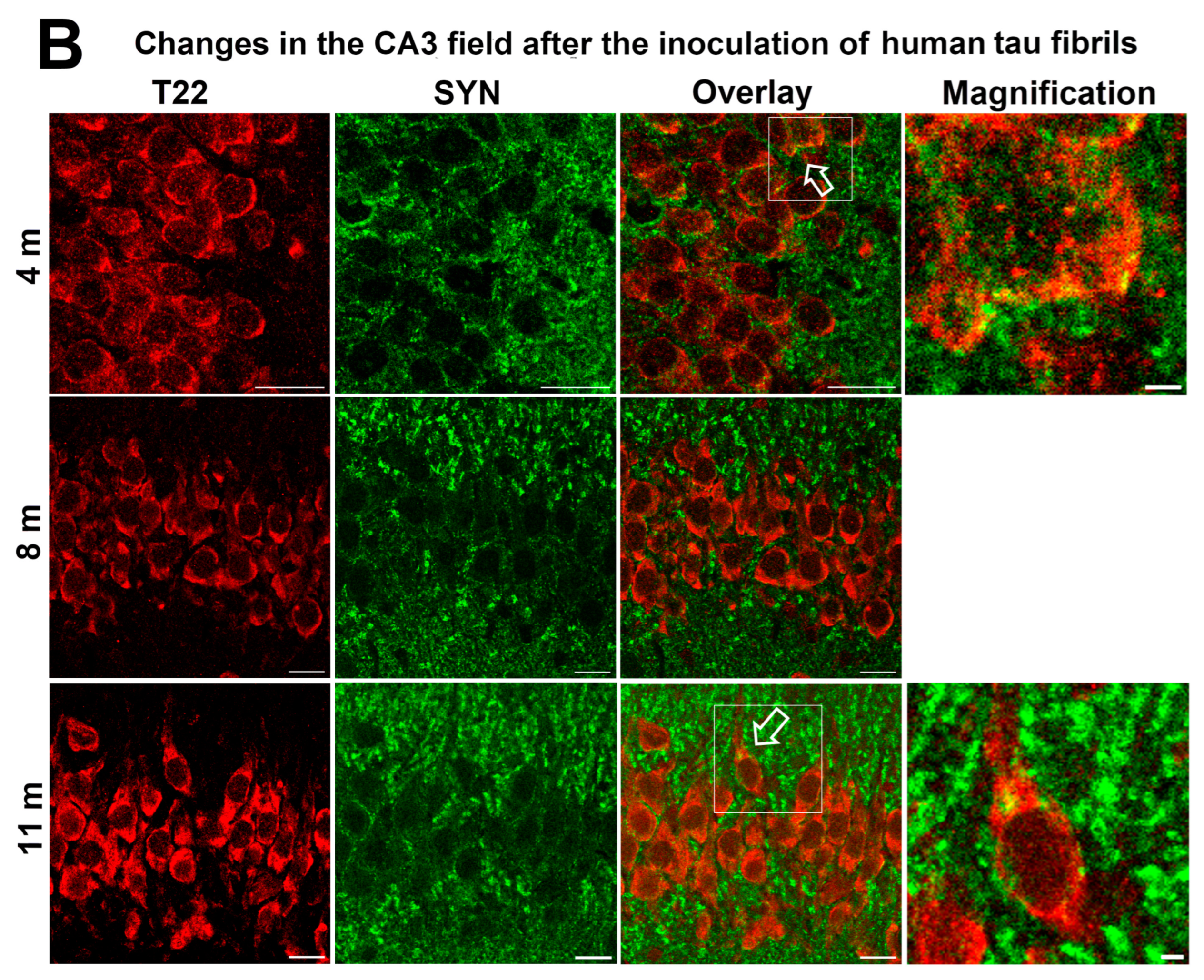 Biomedicines 11 01004 g008b