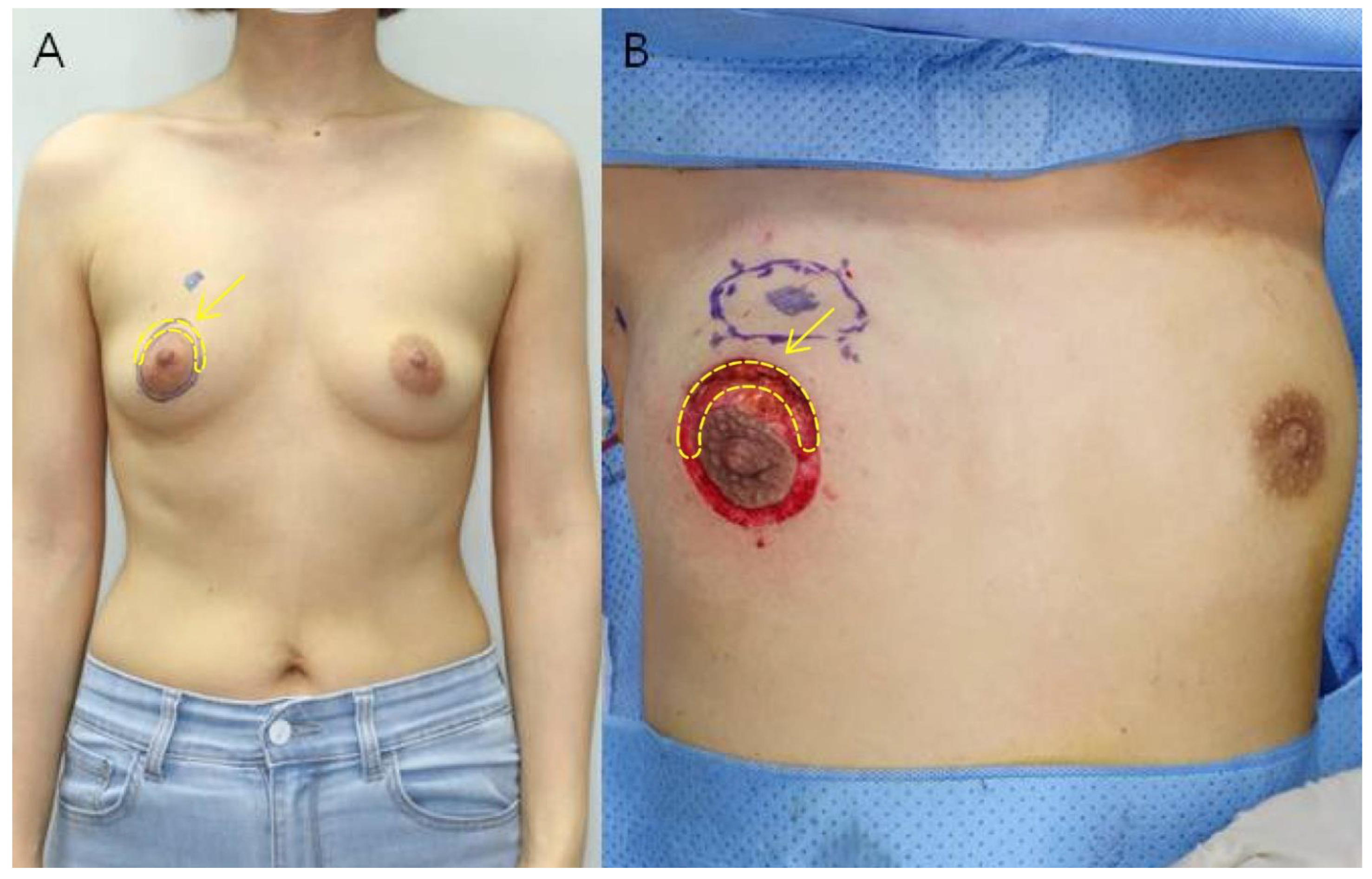 Biomedicines 11 01089 g001 Biomedicines 11 01089 g001