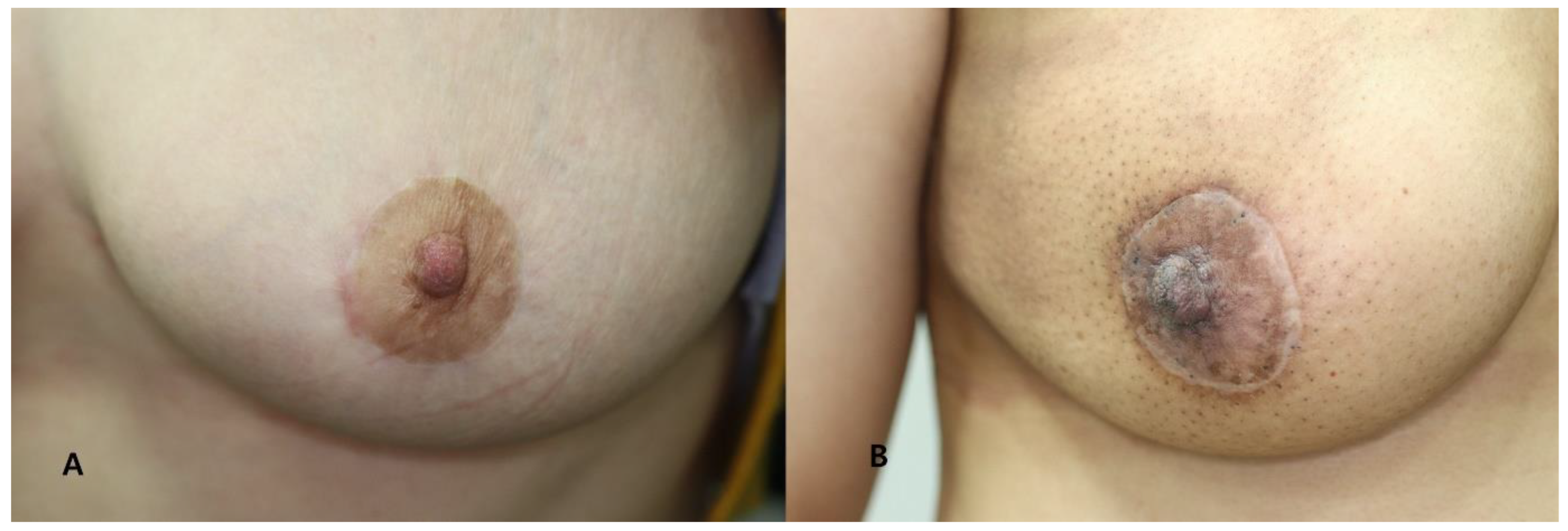 Biomedicines 11 01089 g004 Biomedicines 11 01089 g004