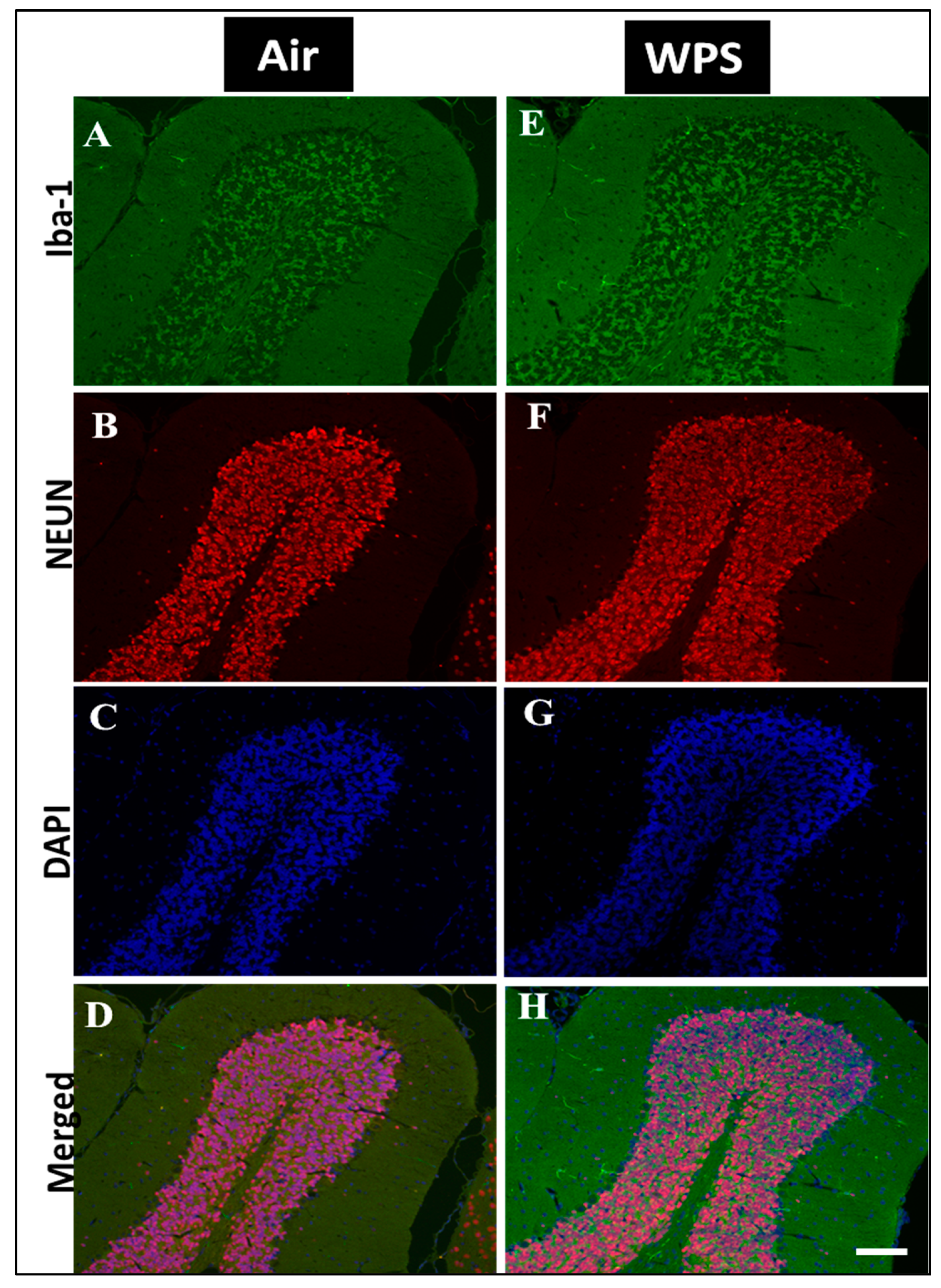 Biomedicines 11 01104 g007 Biomedicines 11 01104 g007