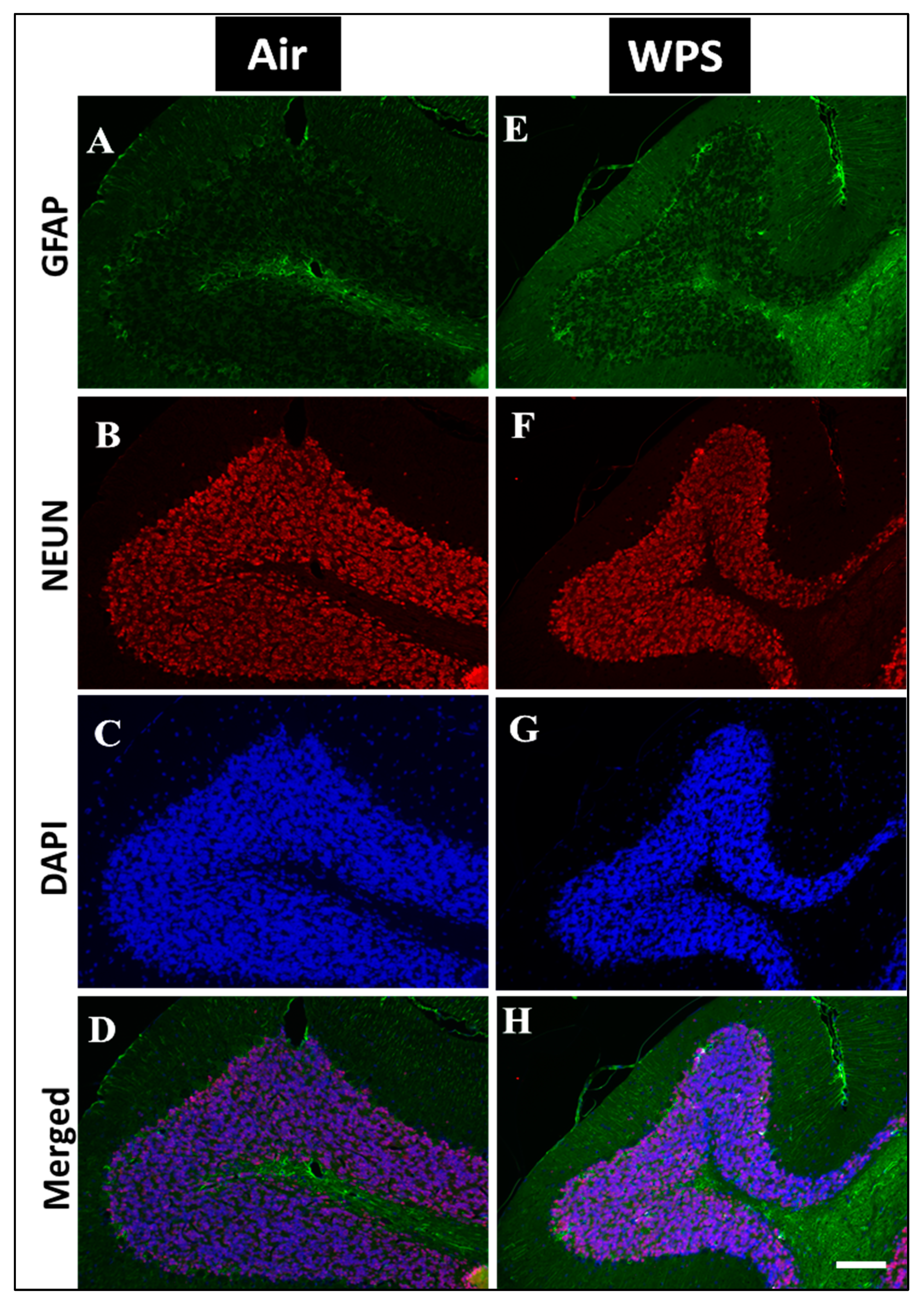 Biomedicines 11 01104 g009 Biomedicines 11 01104 g009