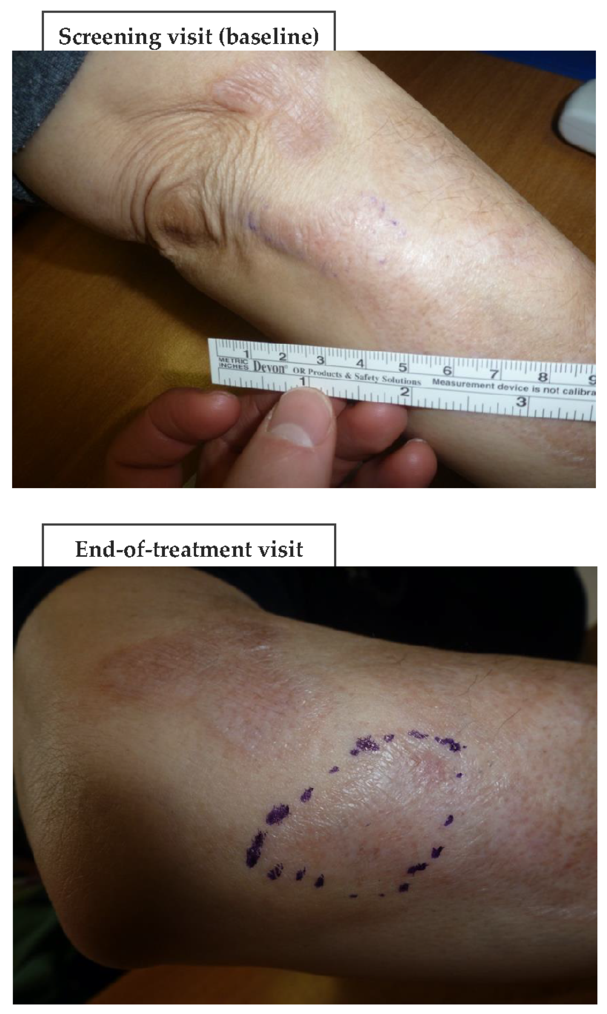 Biomedicines 11 01190 g006a Biomedicines 11 01190 g006a