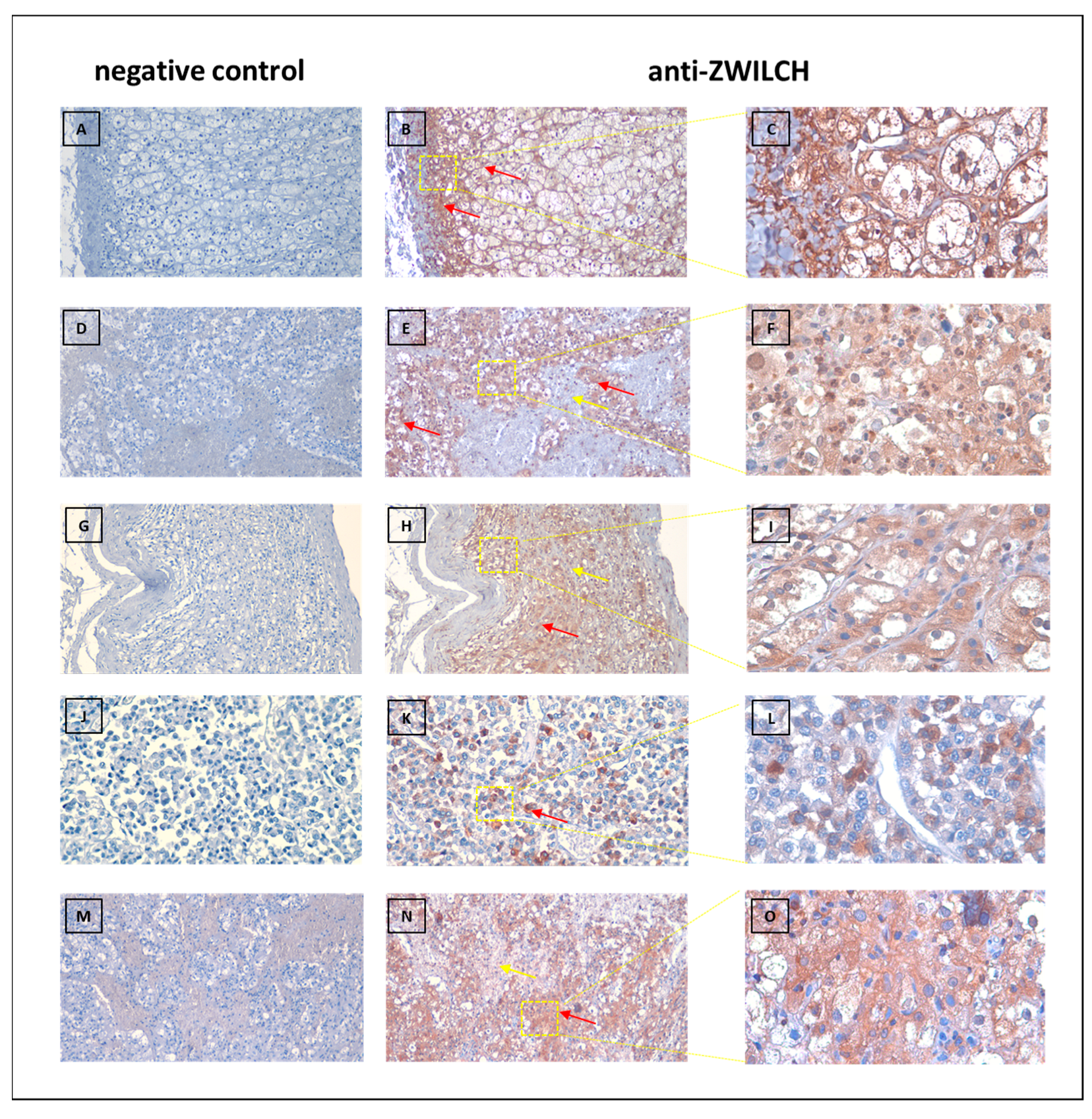 Biomedicines 11 01233 g011