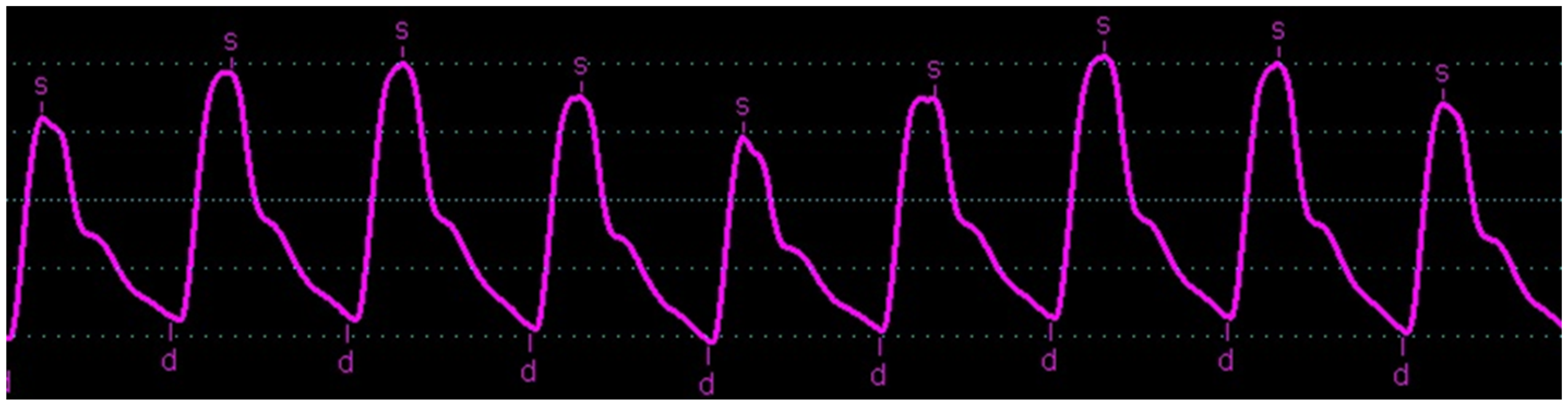 Biomedicines 11 01235 g013