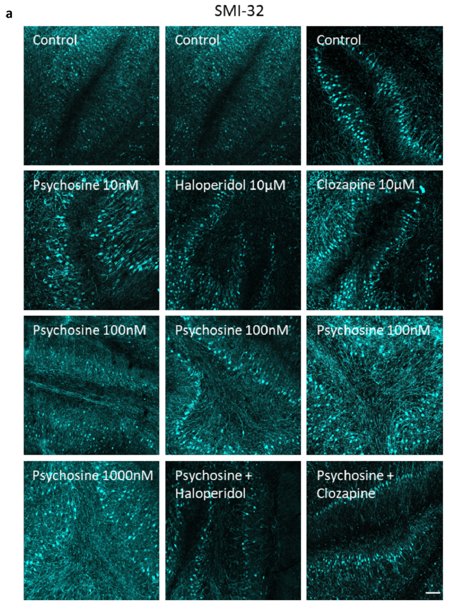Biomedicines 11 01313 g005a