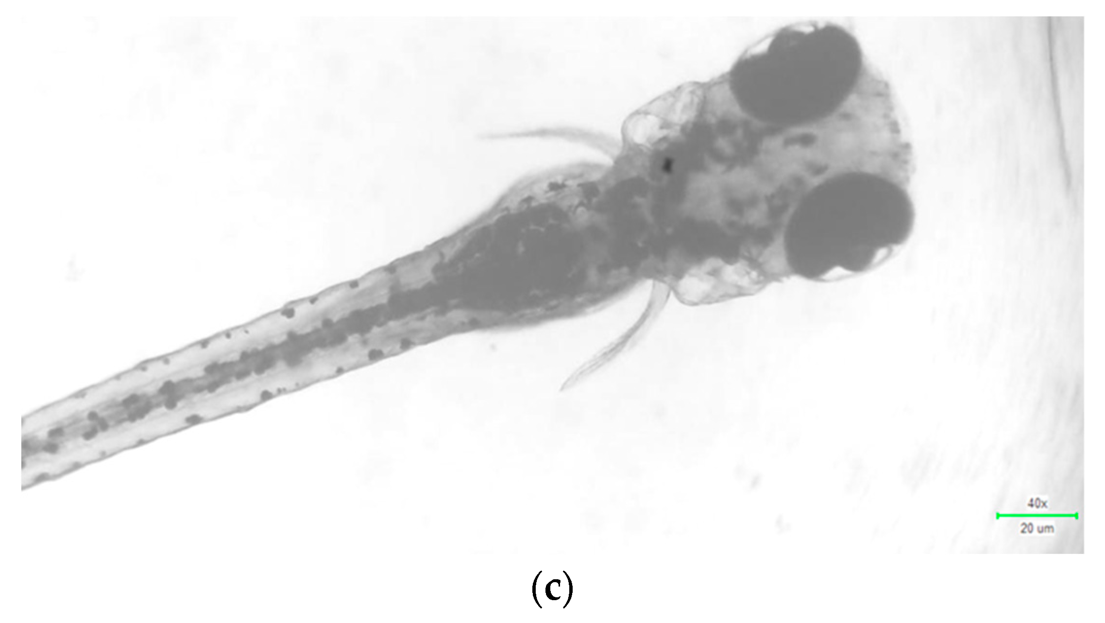 Biomedicines 11 01472 g011b