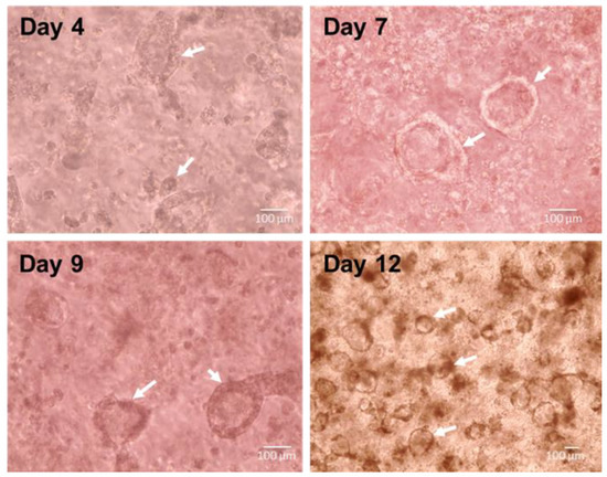 Biomedicines 11 01476 g0a1