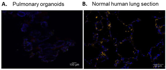 Biomedicines 11 01476 g0a2