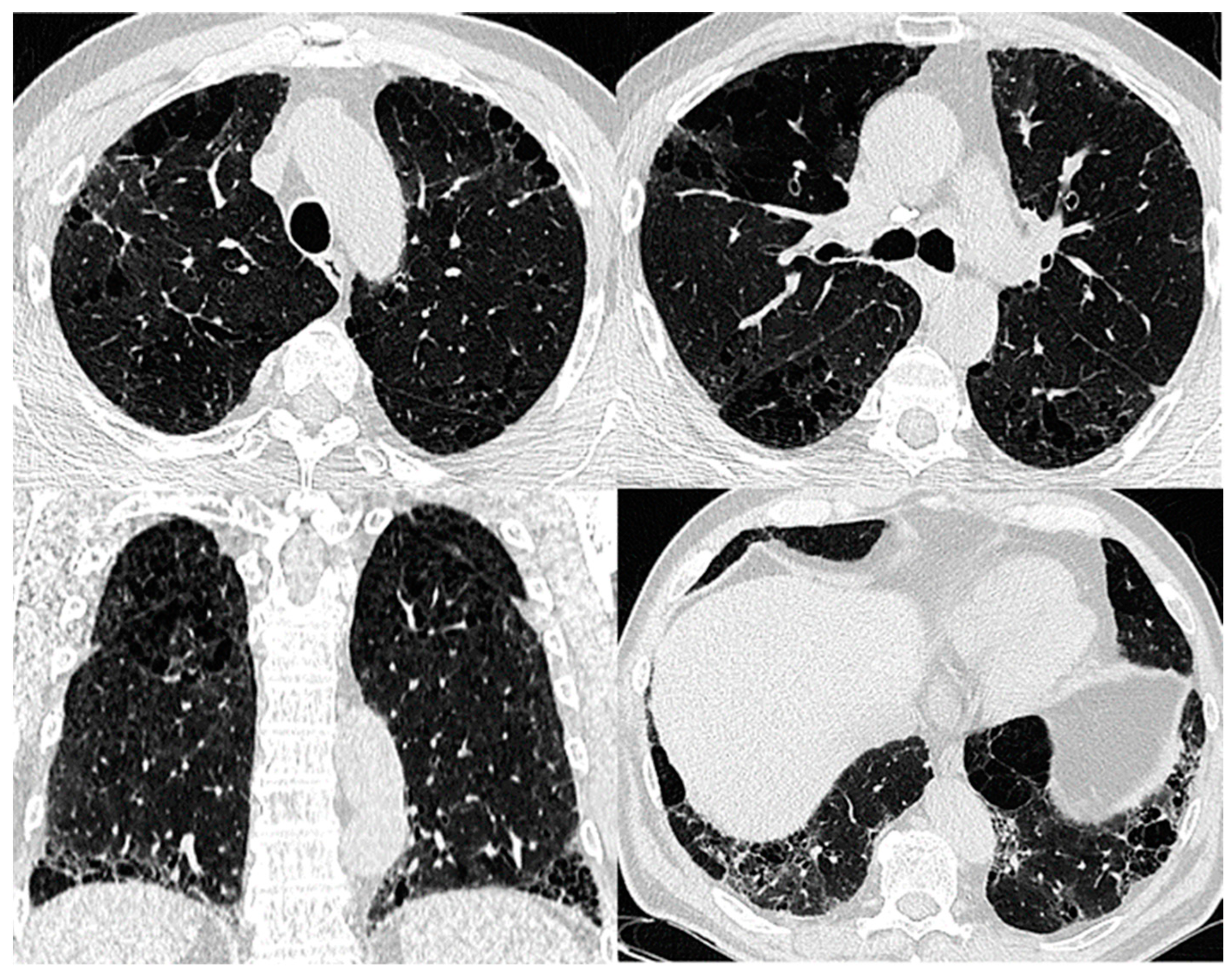 Biomedicines 11 01636 g003