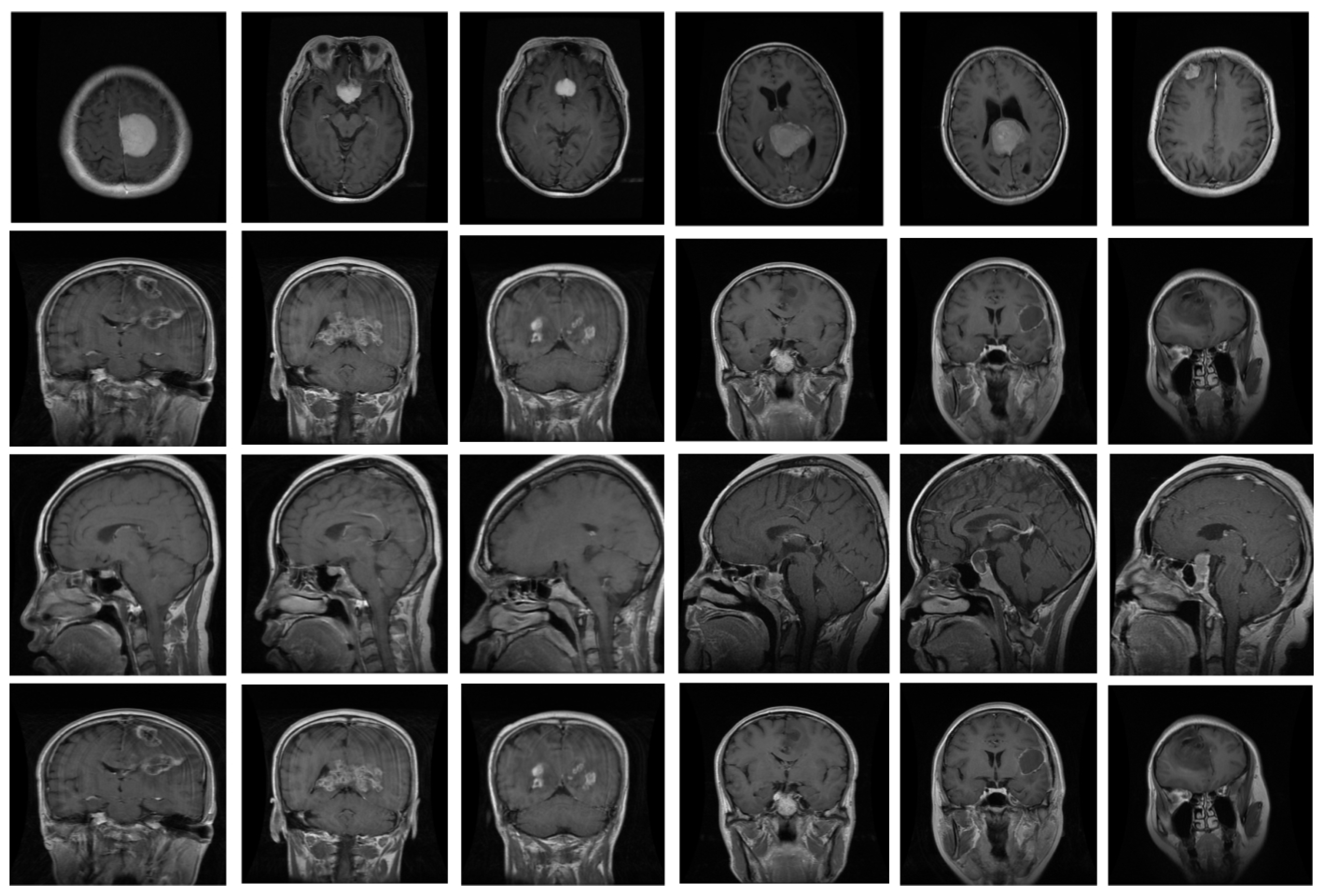 Biomedicines 11 01715 g004