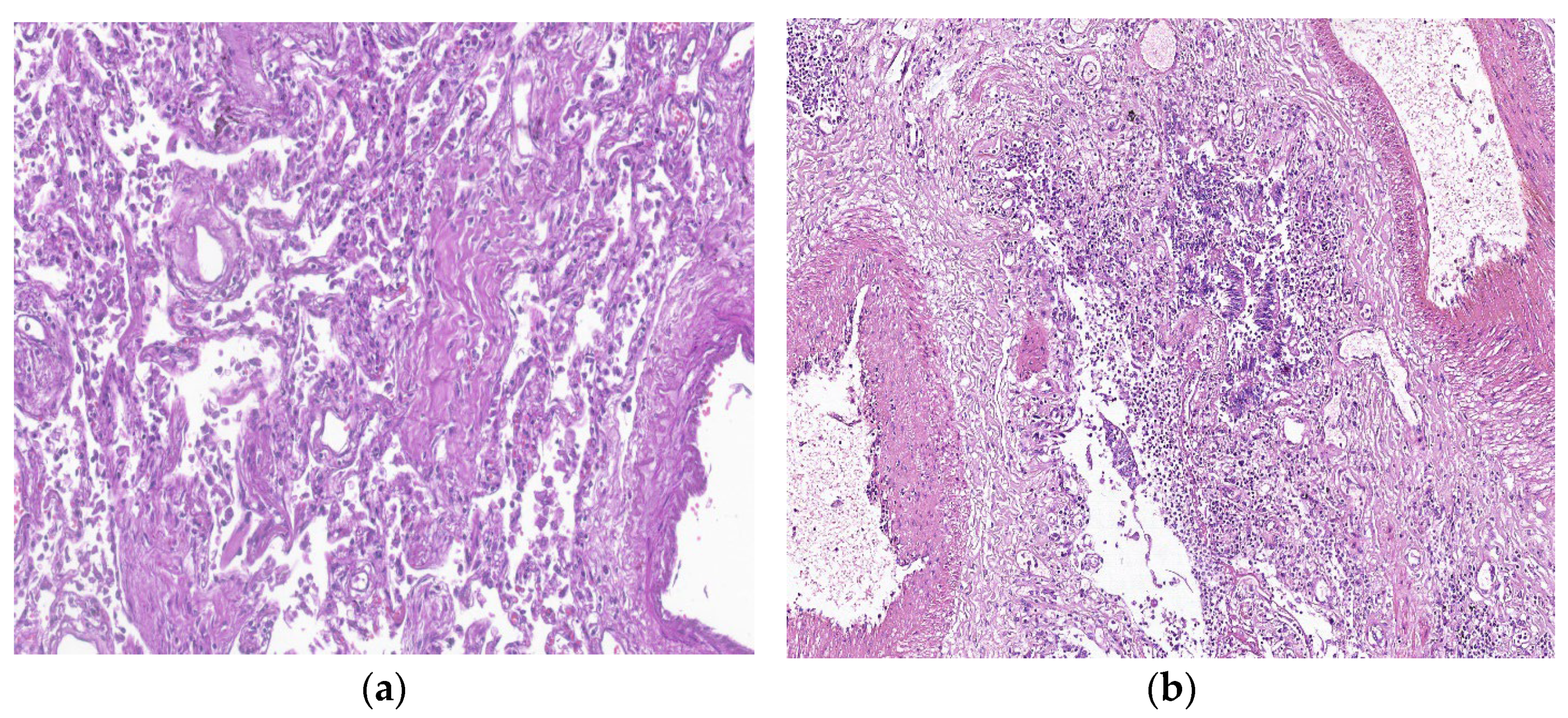 Biomedicines 11 01739 g004