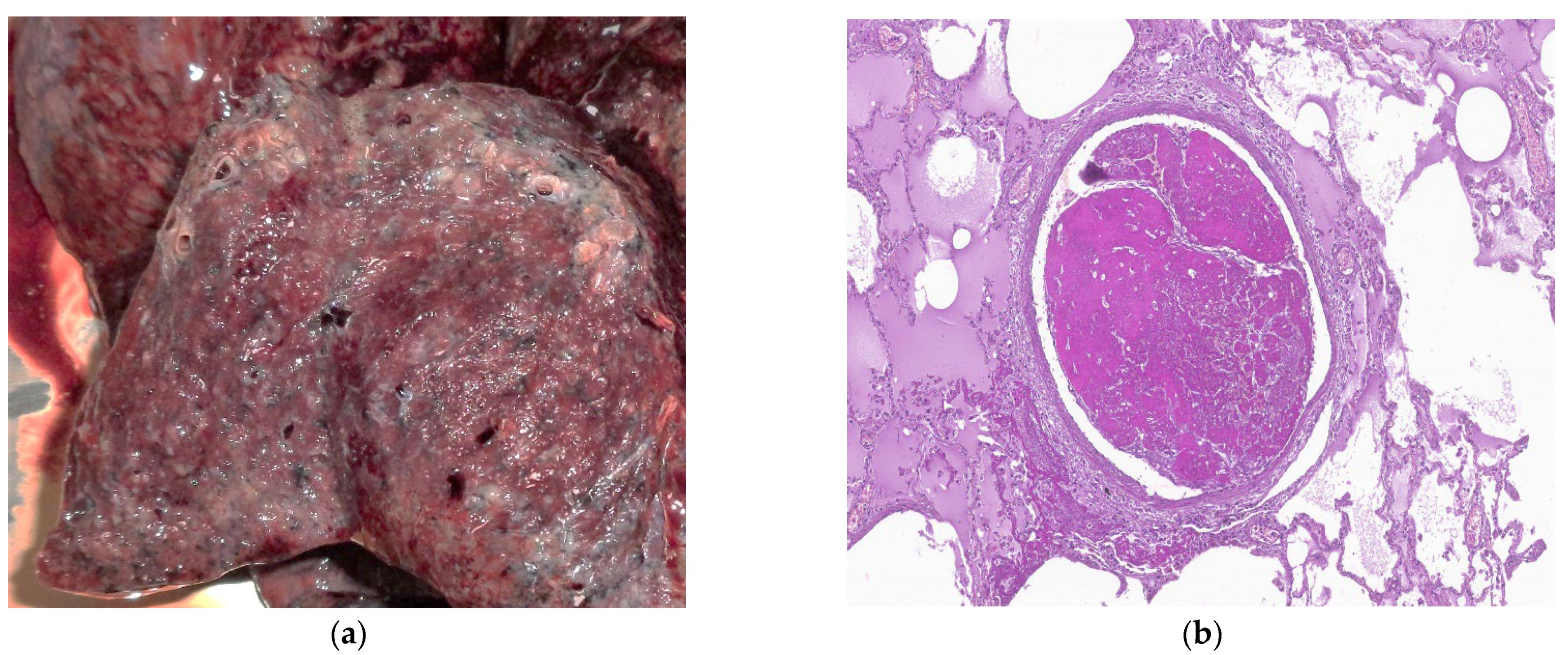 Biomedicines 11 01739 g005