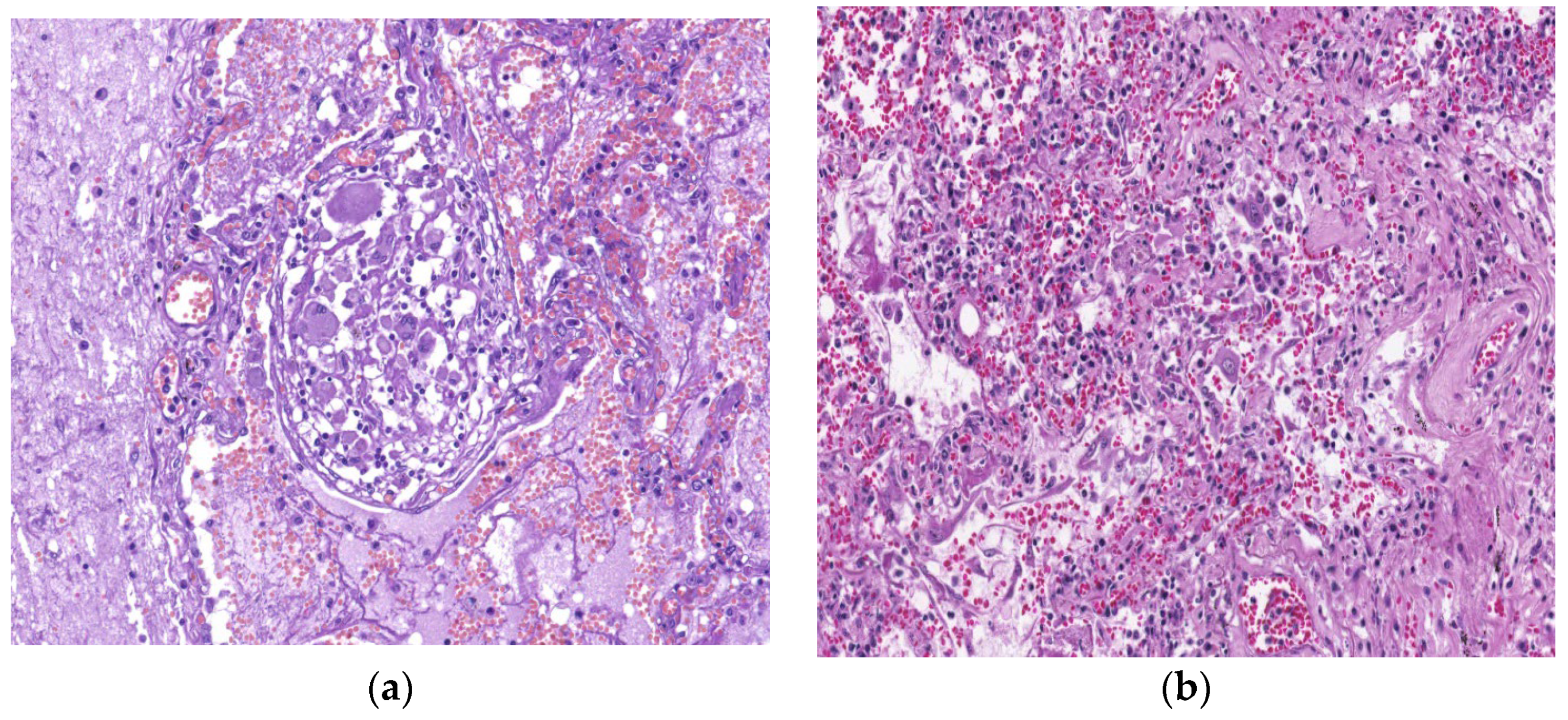 Biomedicines 11 01739 g006