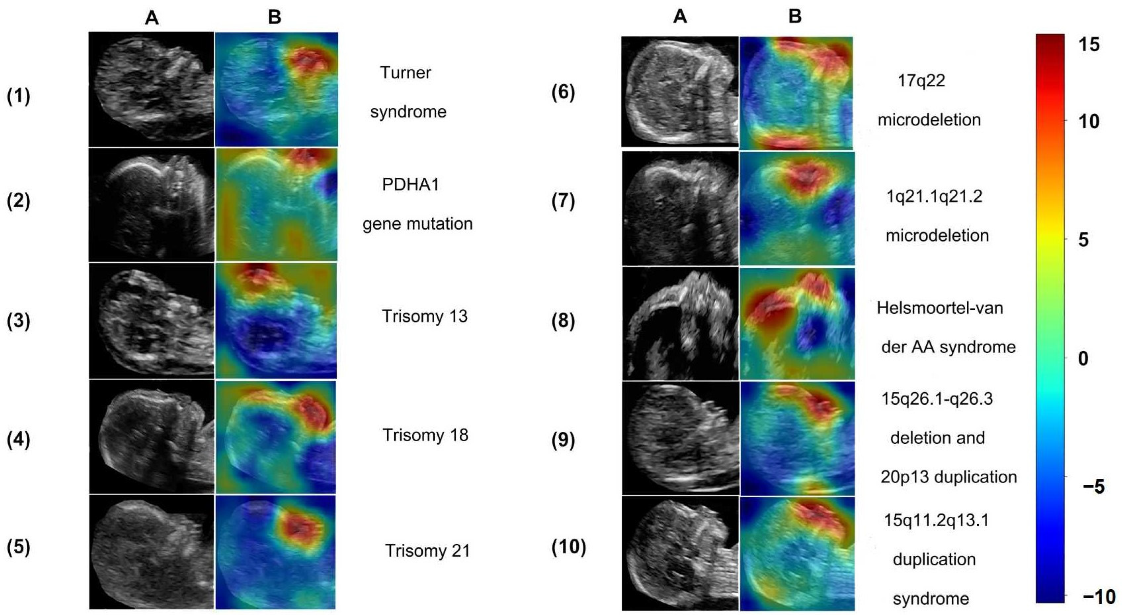 Biomedicines 11 01756 g004