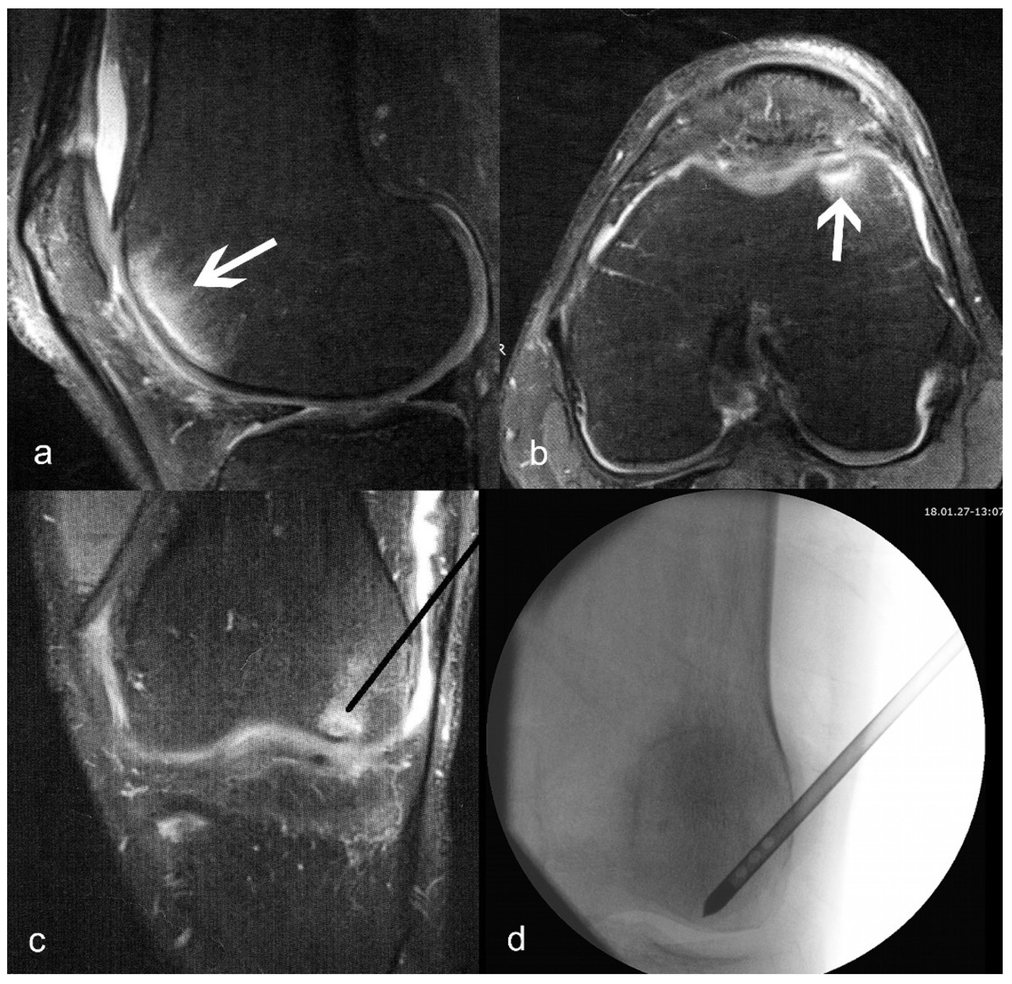 Biomedicines 11 01799 g001