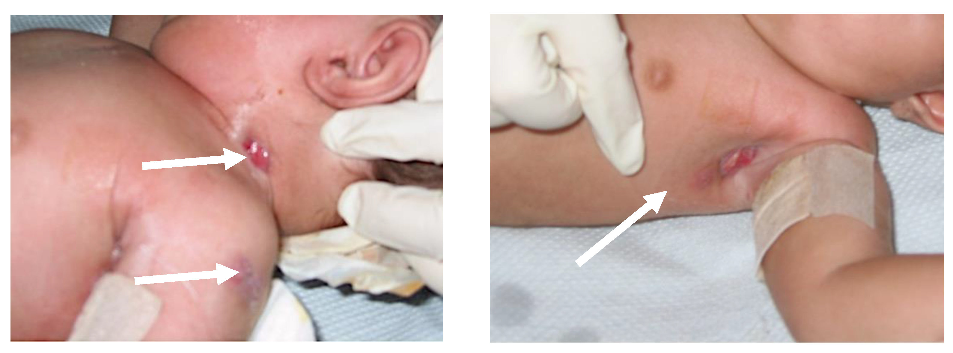 Biomedicines 11 01809 g001 Biomedicines 11 01809 g001