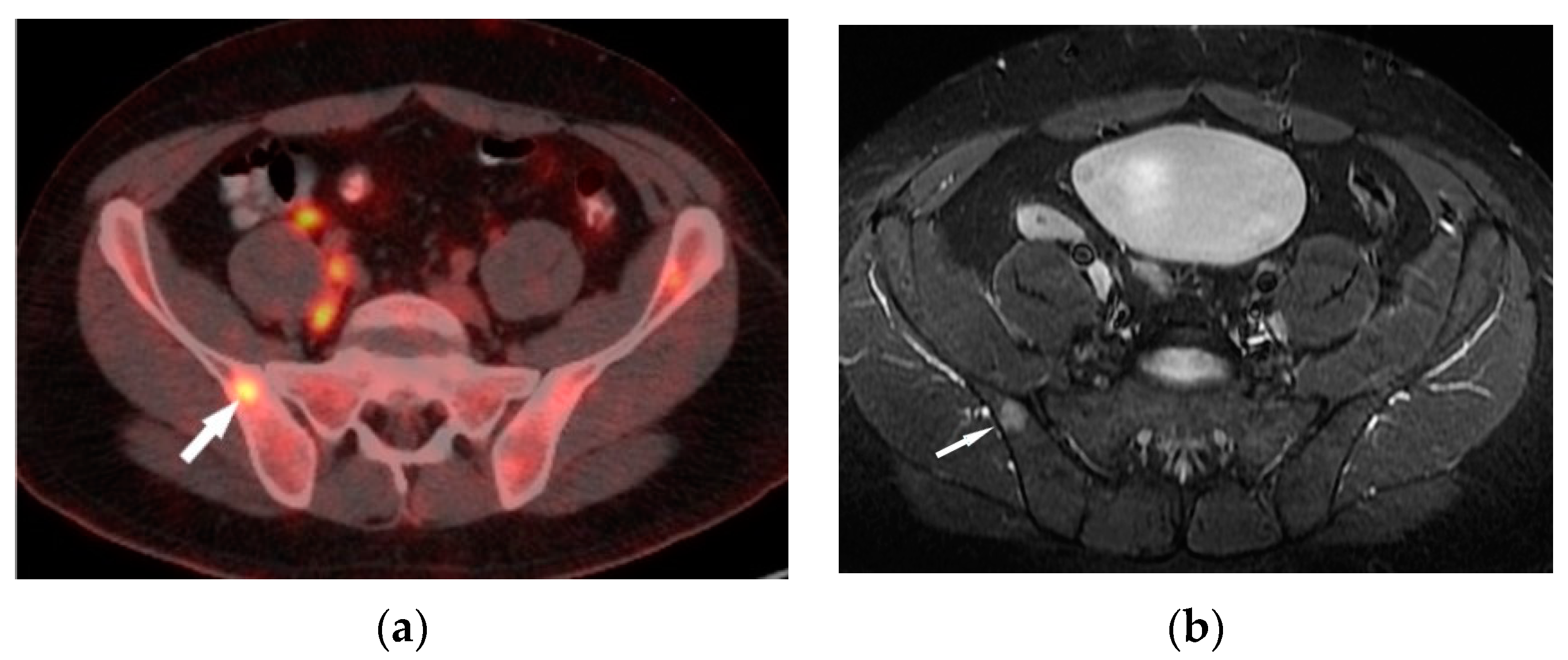 Biomedicines 11 01866 g004
