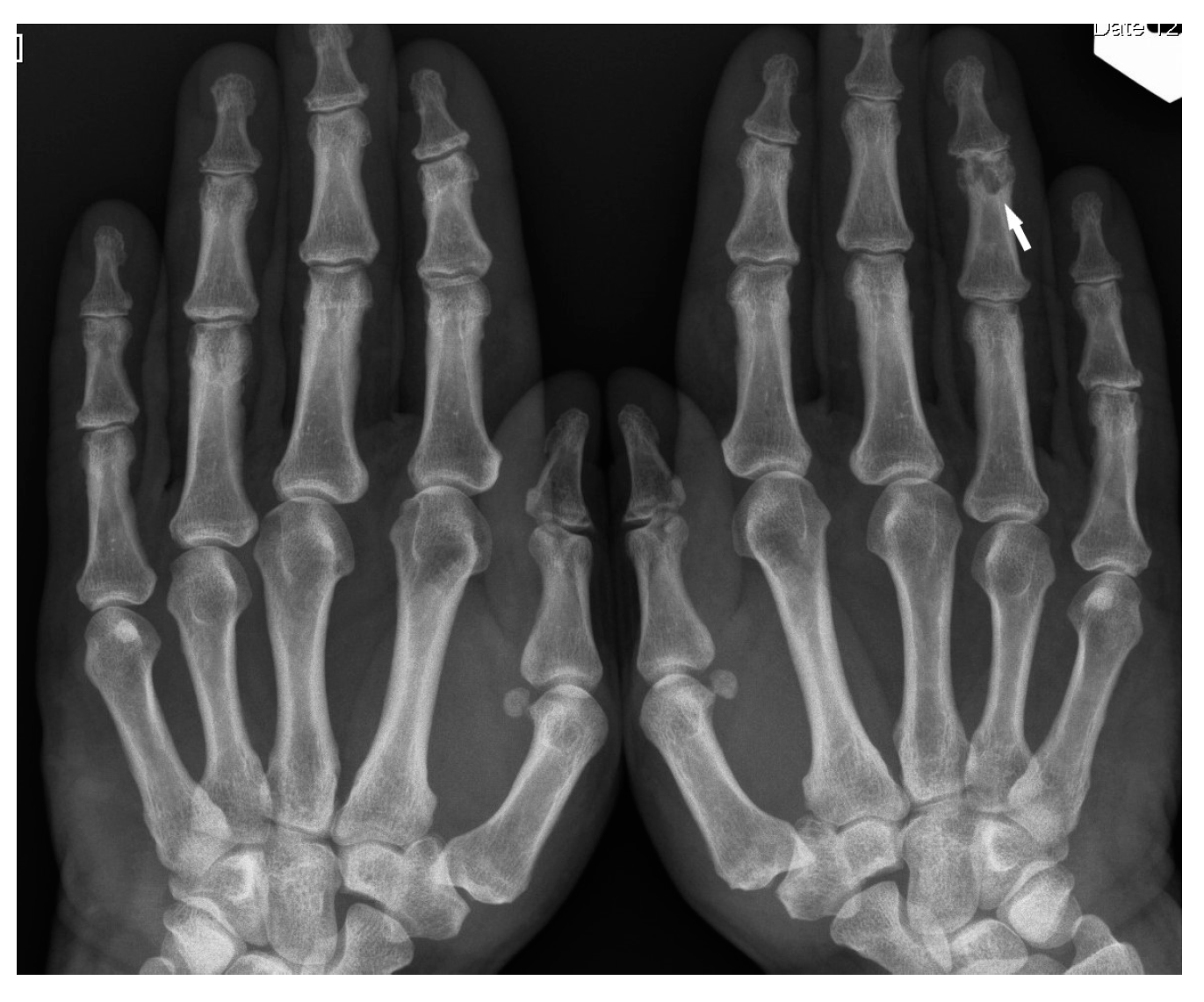 Biomedicines 11 01866 g007