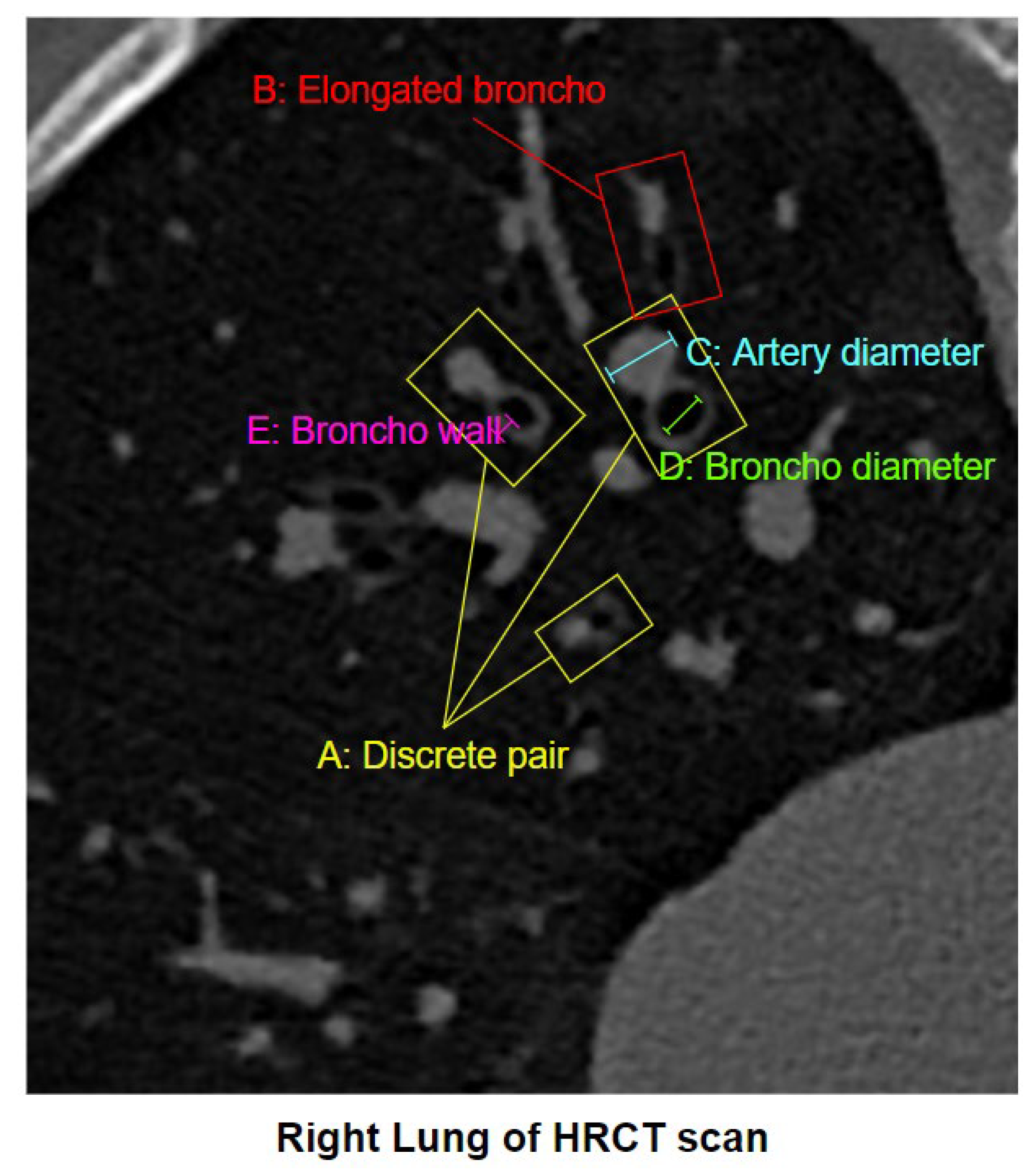 Biomedicines 11 01874 g002 Biomedicines 11 01874 g002