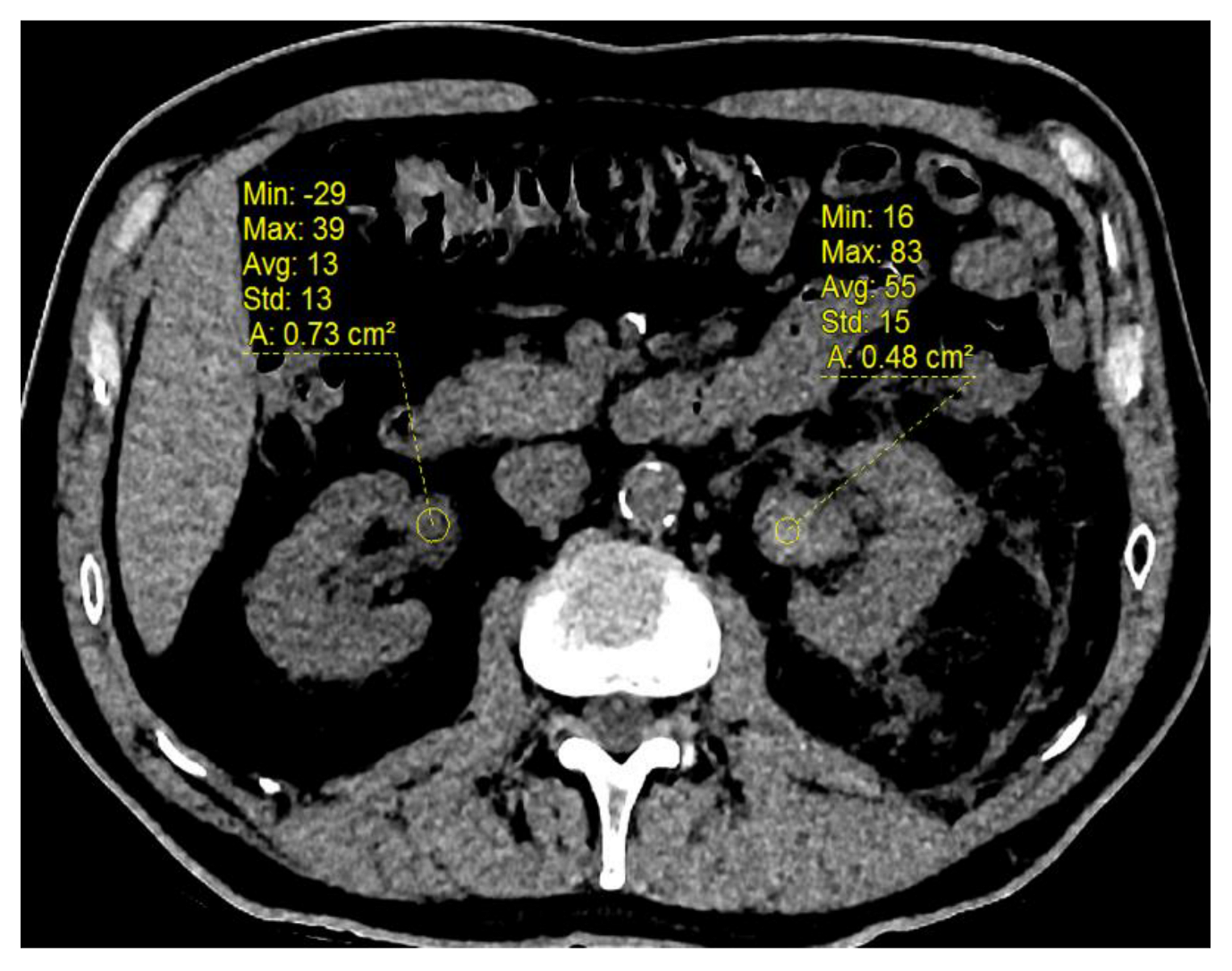 Biomedicines 11 01935 g003