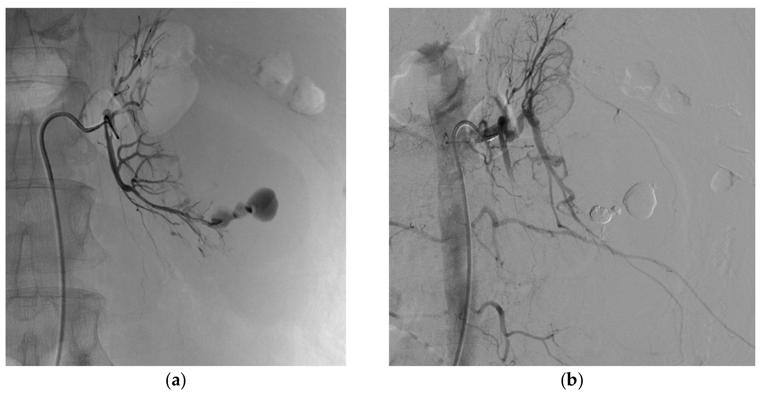 Biomedicines 11 01935 g005