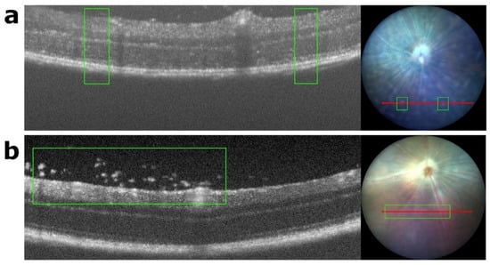 Biomedicines 11 02022 g0a4