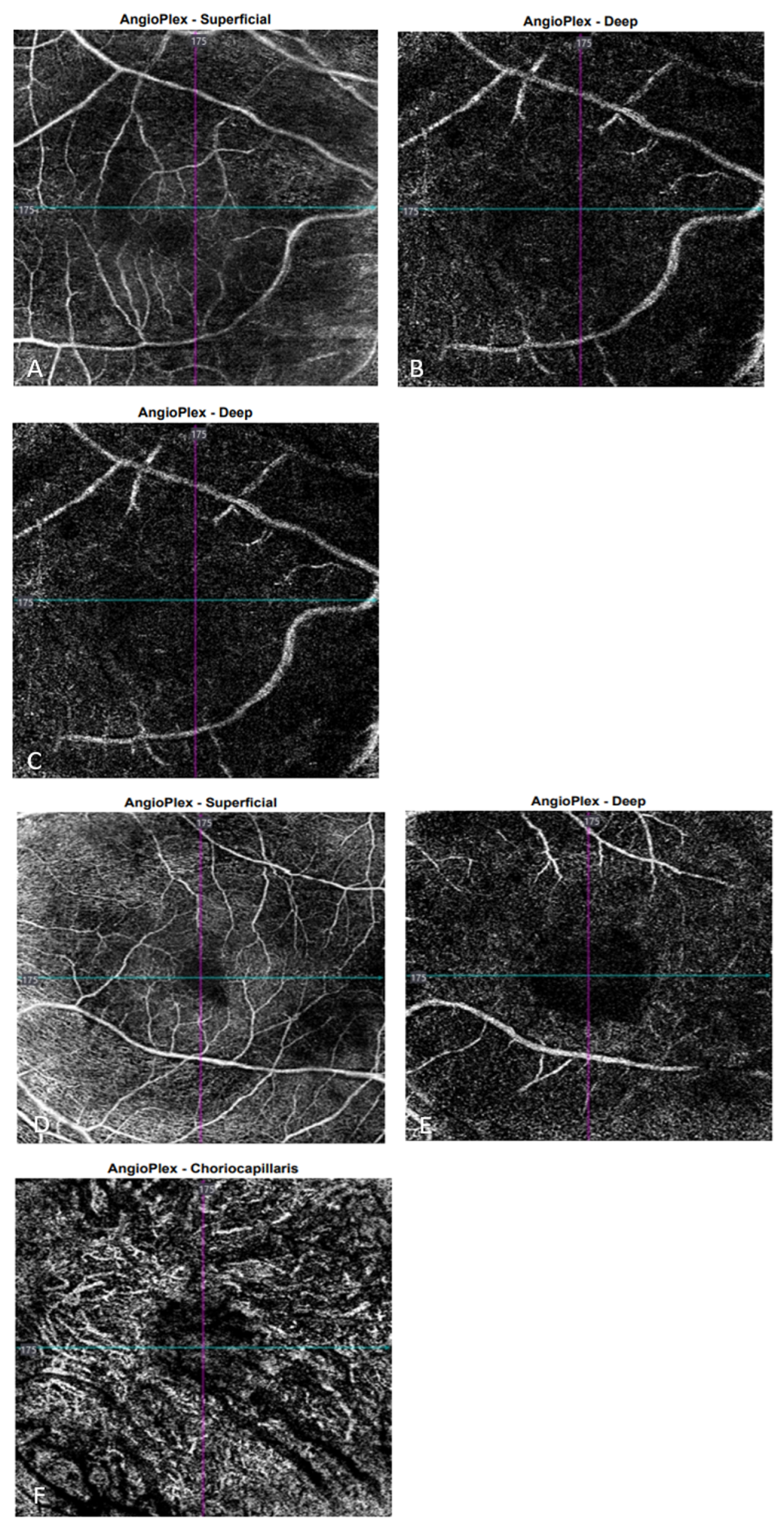 Biomedicines 11 02074 g006 Biomedicines 11 02074 g006
