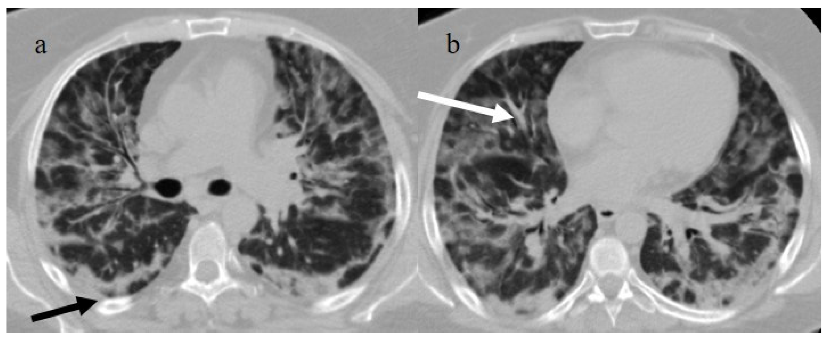 Biomedicines 11 02113 g001