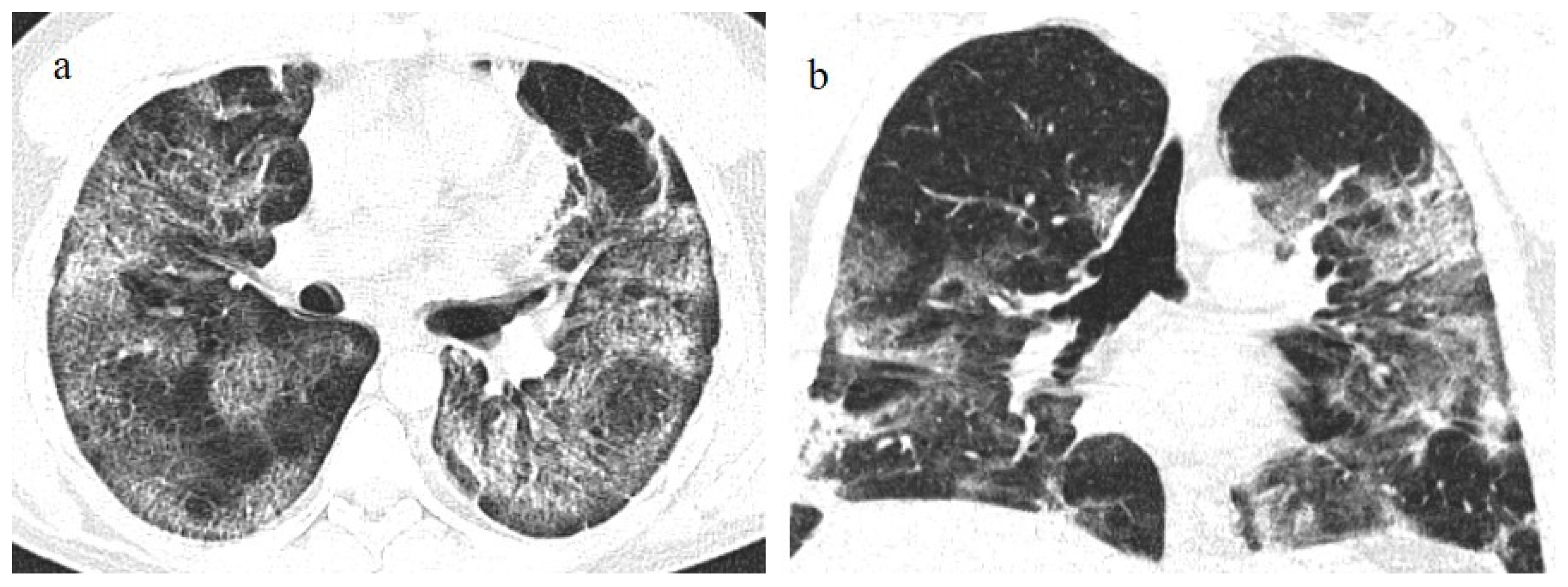 Biomedicines 11 02113 g004