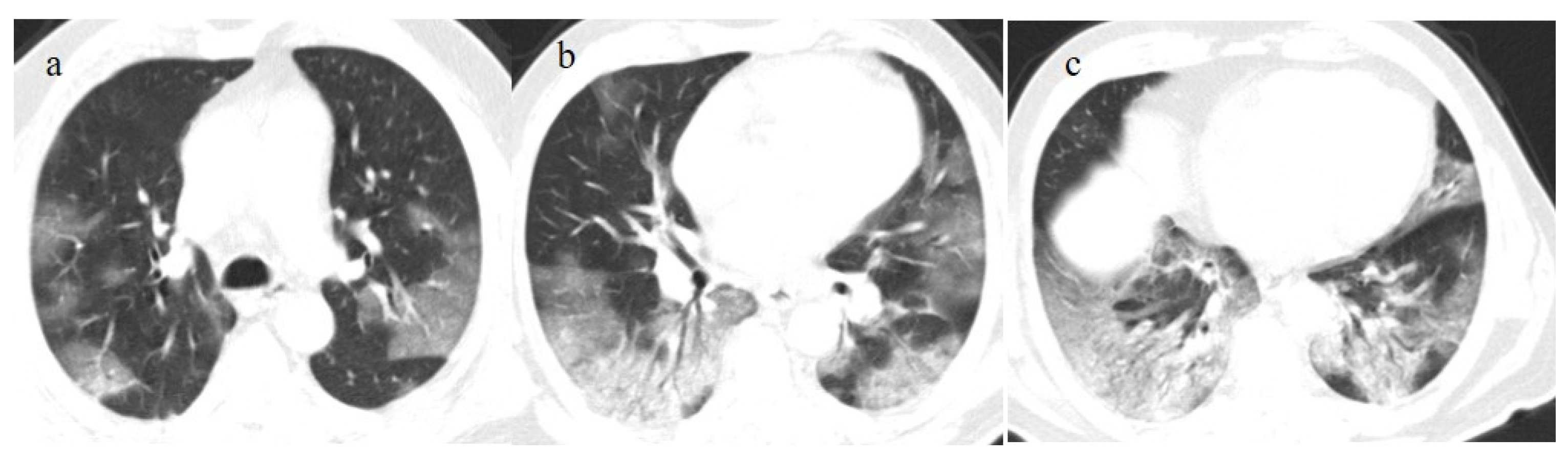 Biomedicines 11 02113 g005