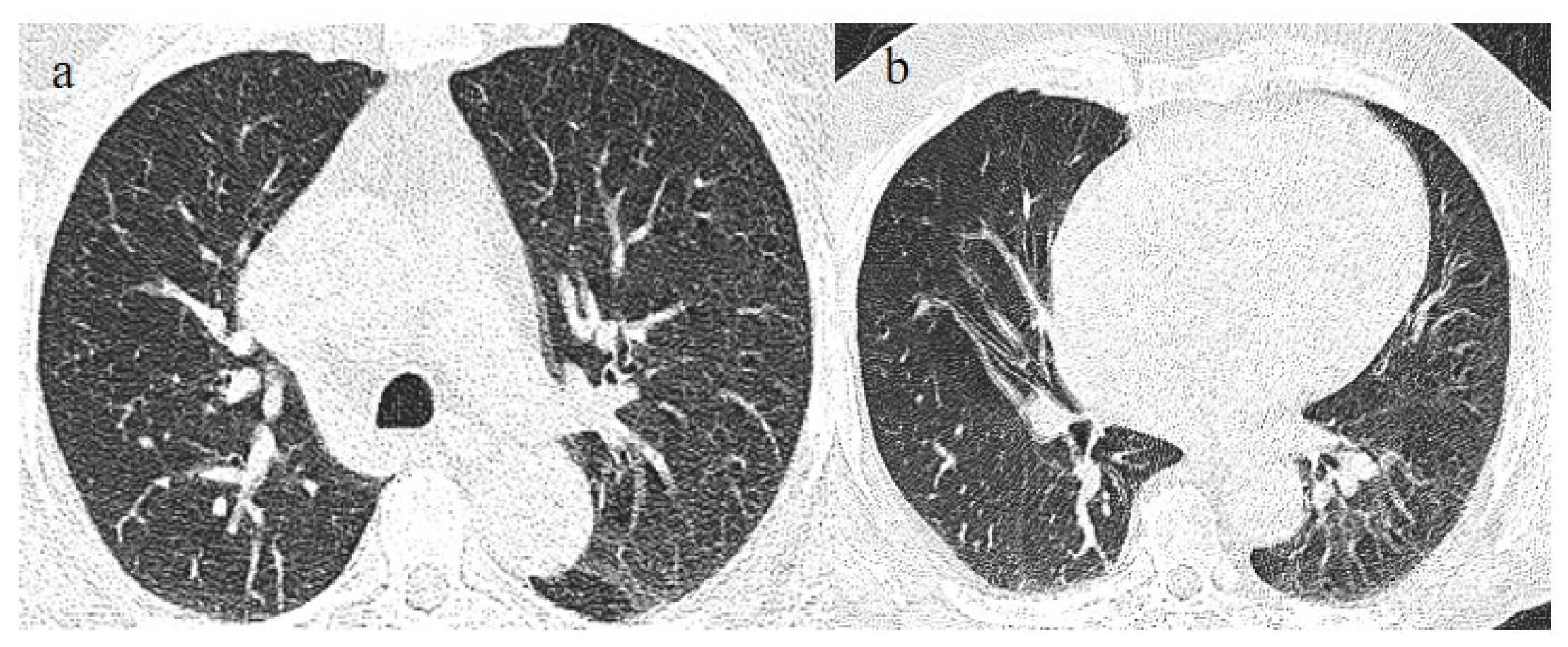 Biomedicines 11 02113 g007