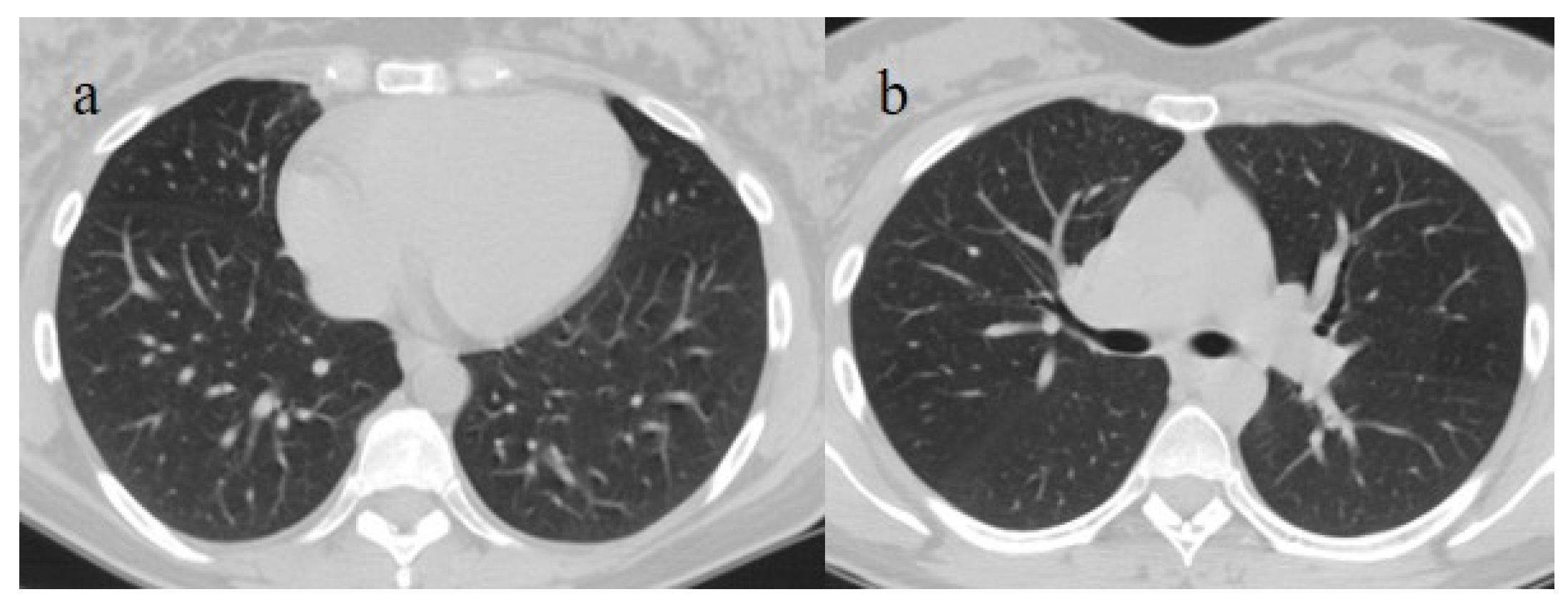 Biomedicines 11 02113 g008